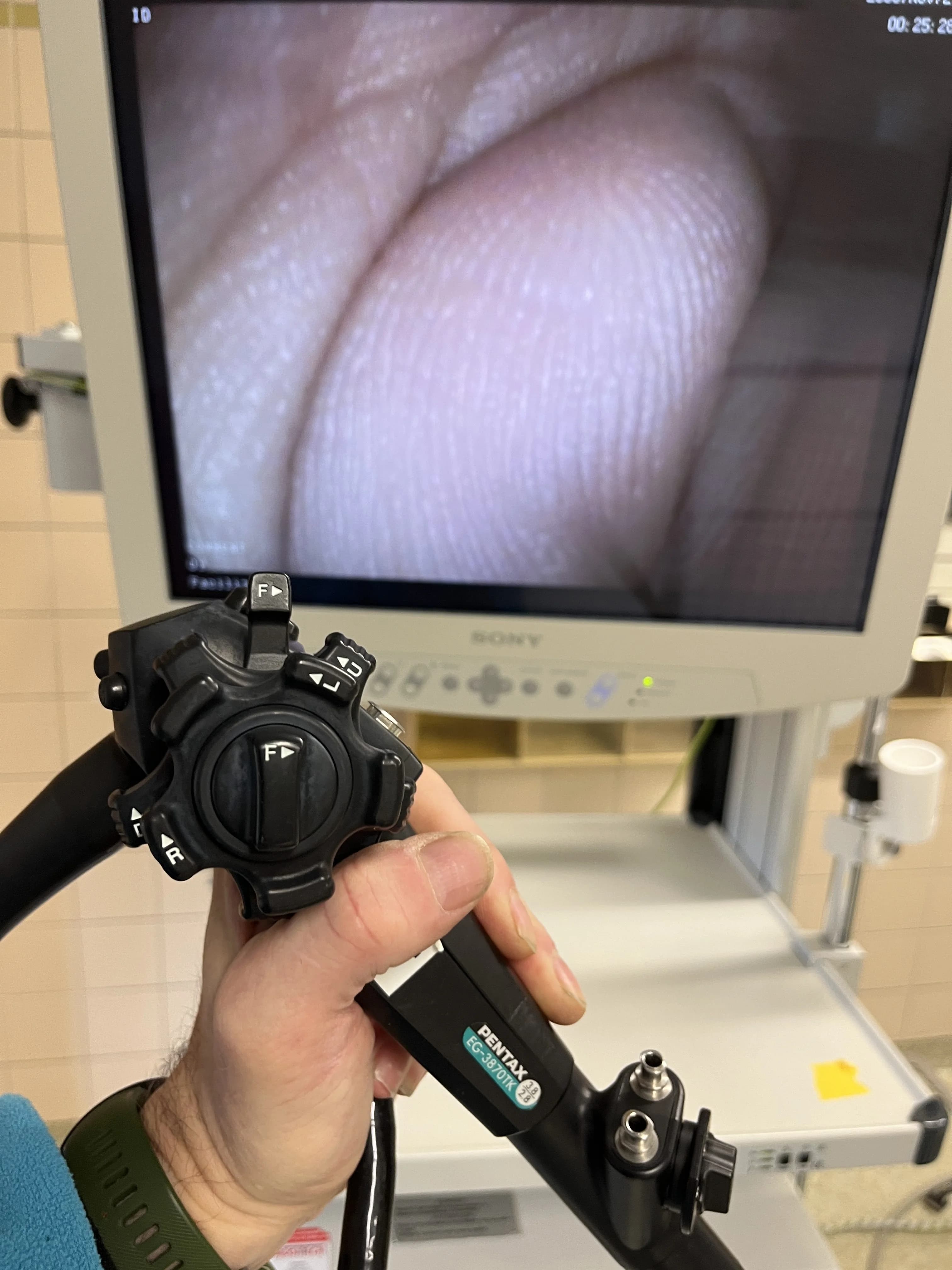 PENTAX EG-3870TK Video gastroscope