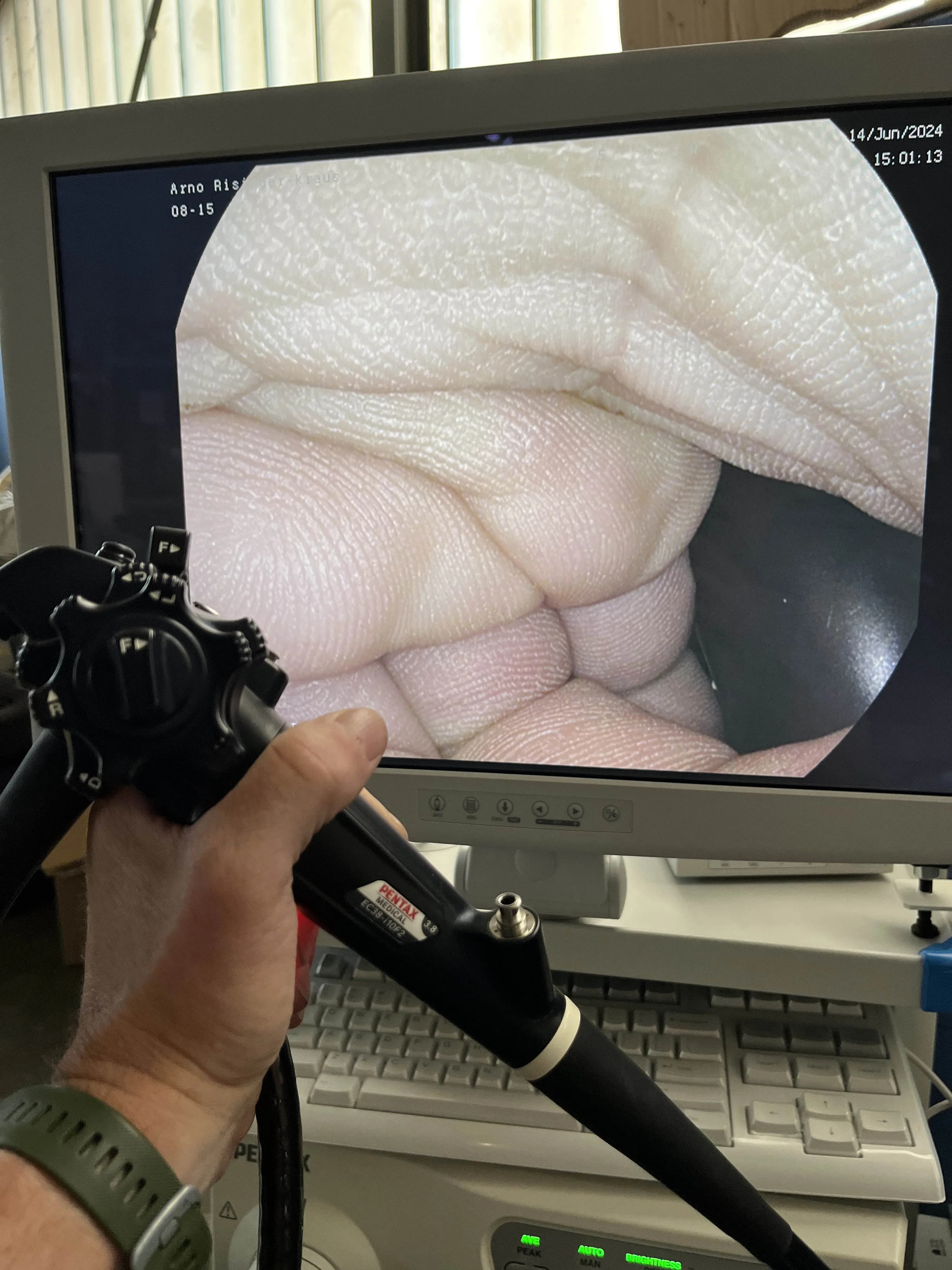 PENTAX EC38-i10F2 Video colonoscope
