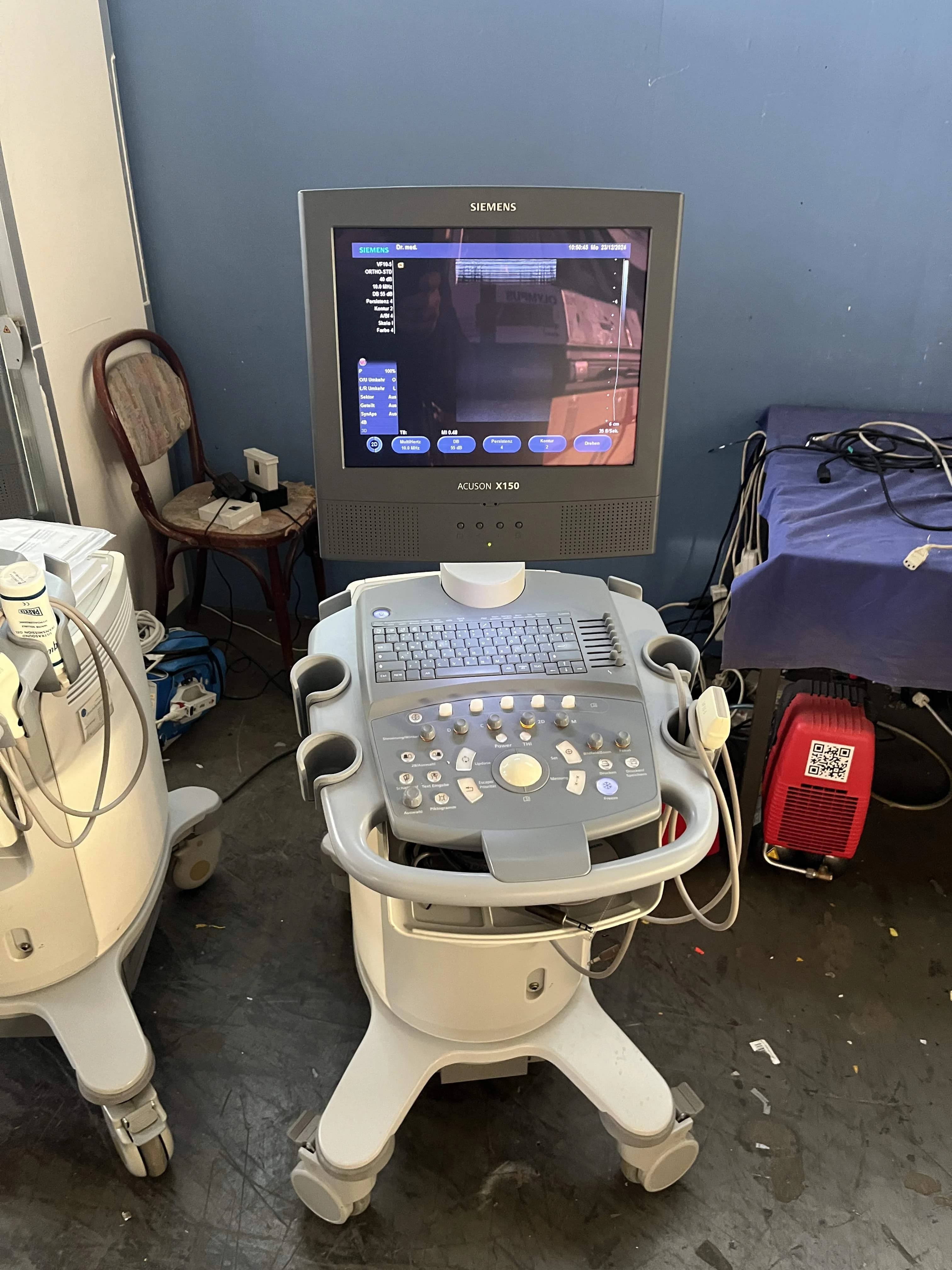 SIEMENS ACUSON X150 Ultrasound Machine