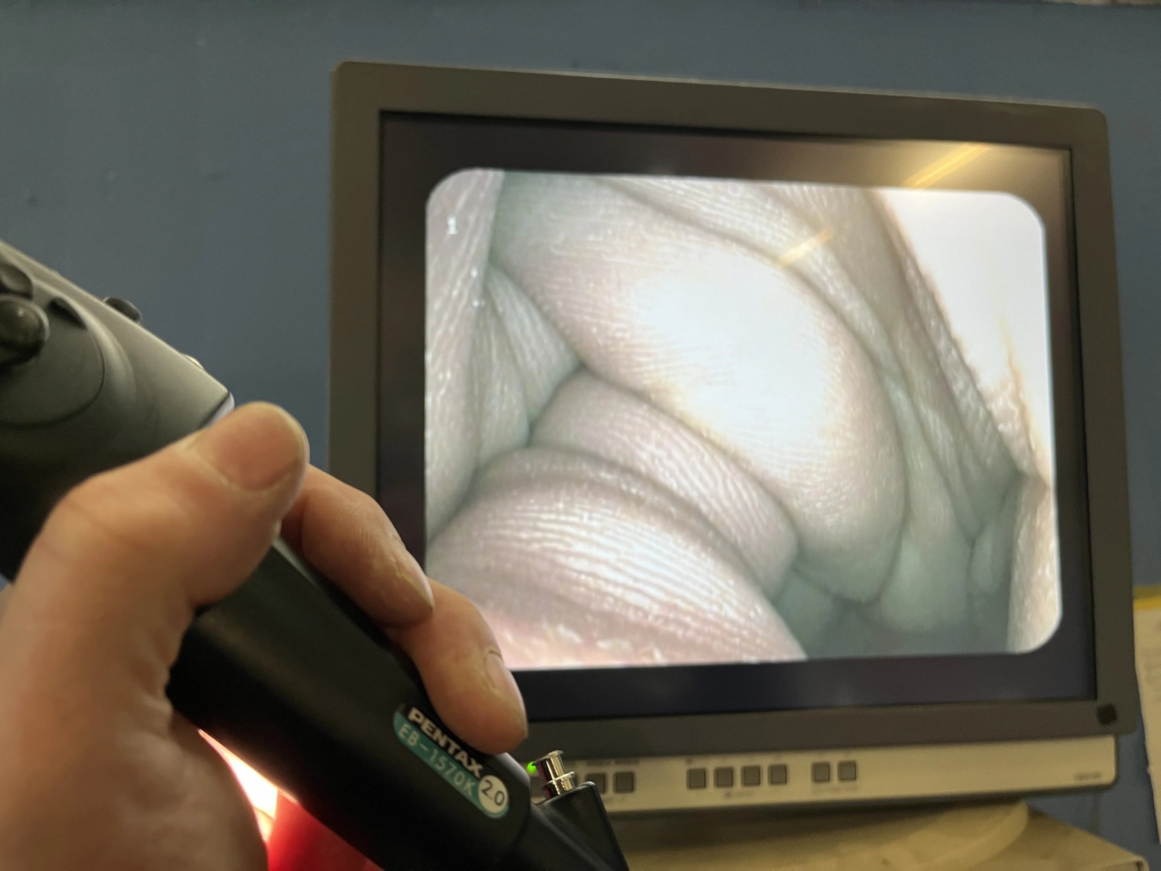 PENTAX EB-1570K Video bronchoscope