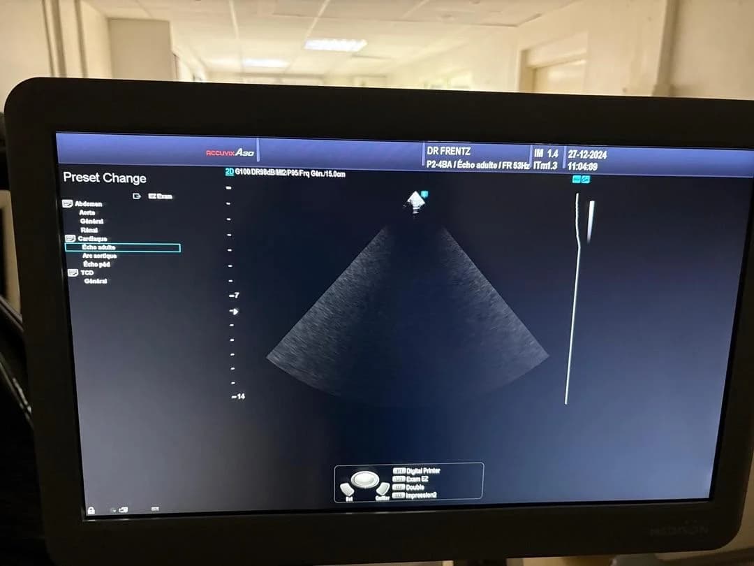 SAMSUNG P2-4BA Cardiac Probe