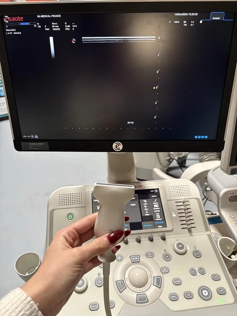 ESAOTE MyLab X6 Ultrasound Machine