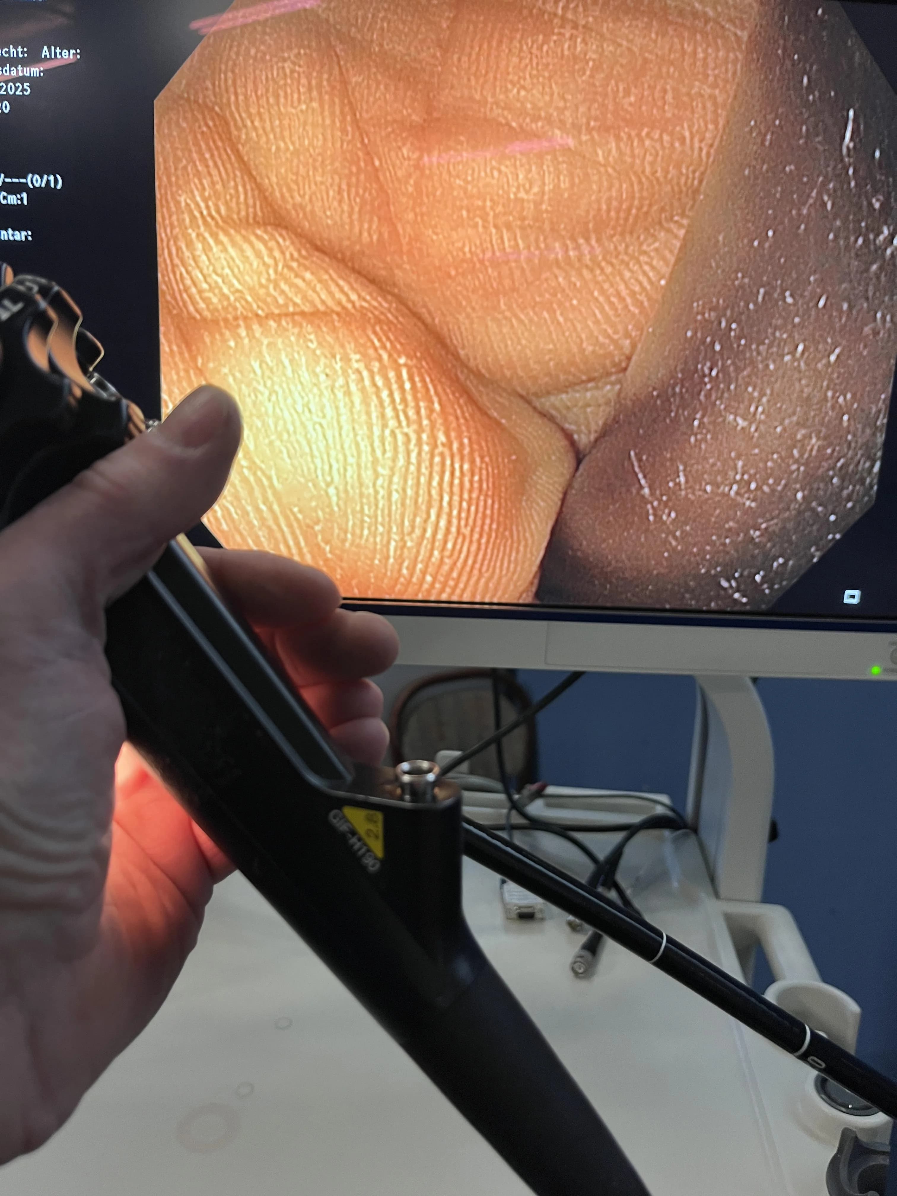 OLYMPUS CF-H190L Video colonoscope