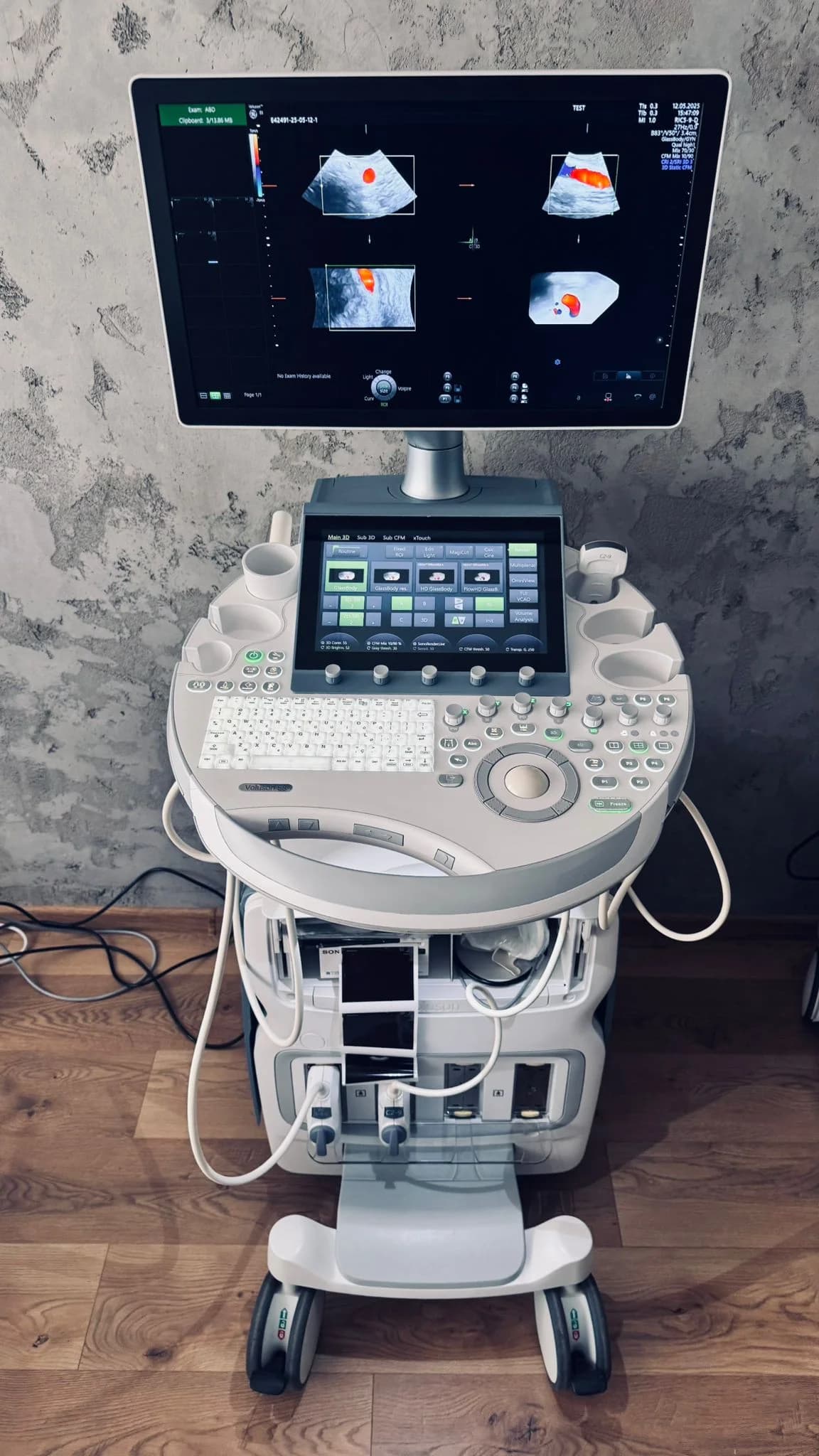 GE Voluson E8 Ultrasound Machine