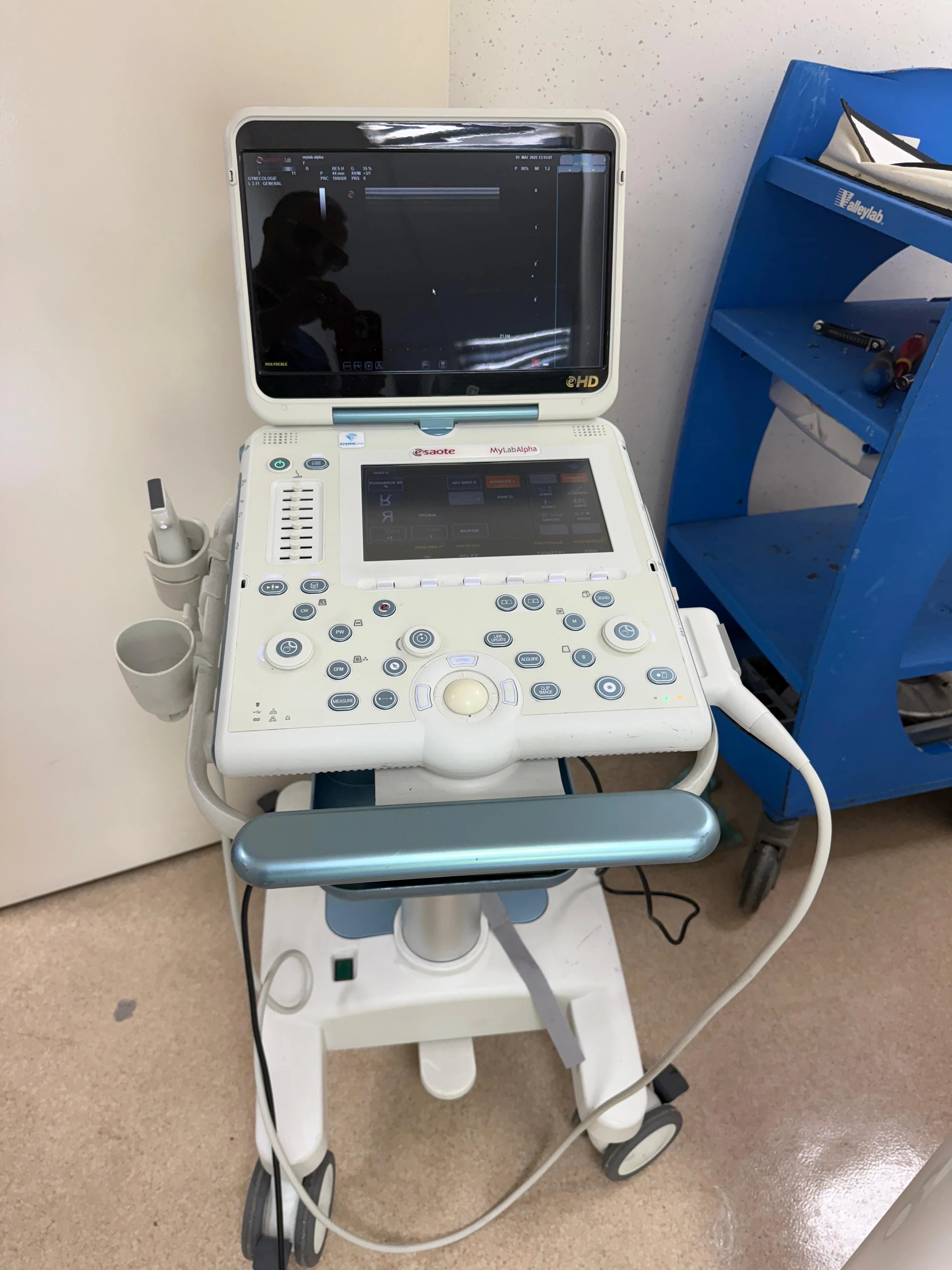 ESAOTE MyLab Alpha Ultrasound Machine
