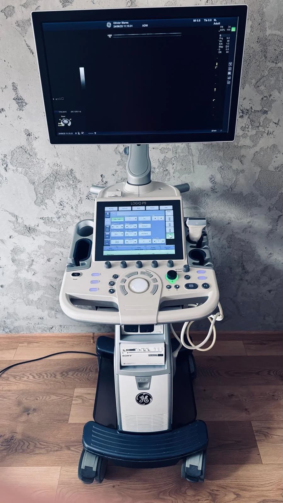 GE Logiq P9 XDclear Ultrasound Machine