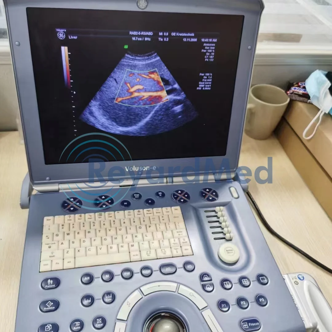 GE RAB2-5-RS 4D Convex Probe