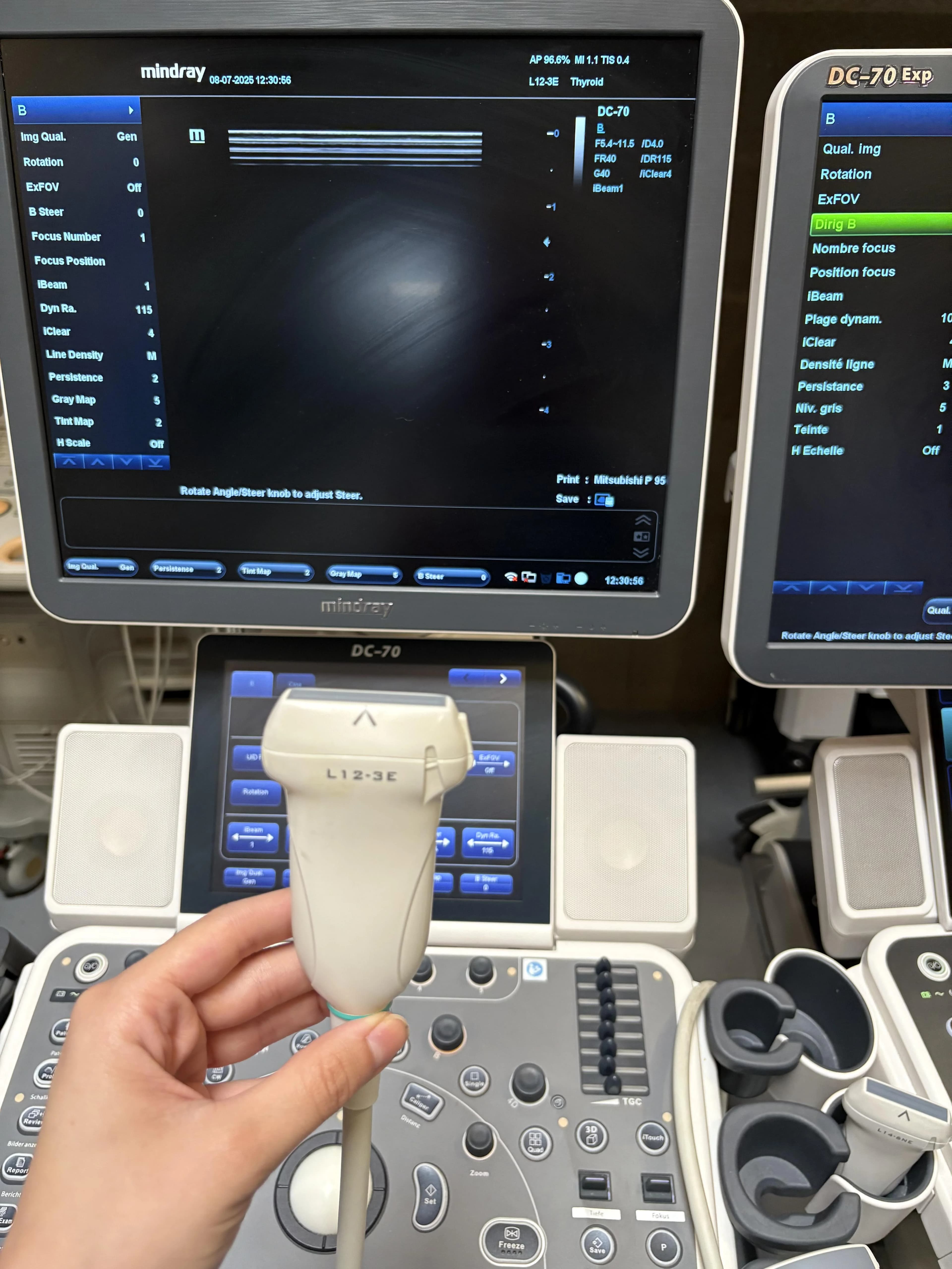 MINDRAY DC-70 Ultrasound Machine