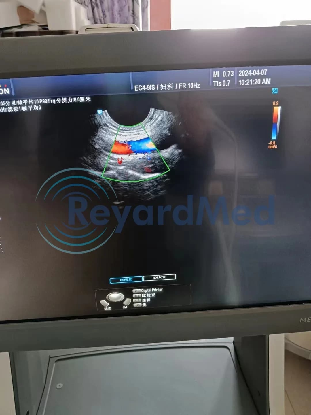SAMSUNG EC4-9IS Endocavity probe