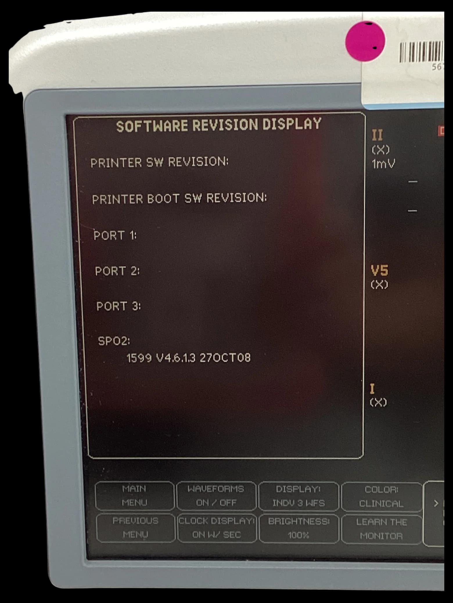 GE Dash 4000 EKG monitor