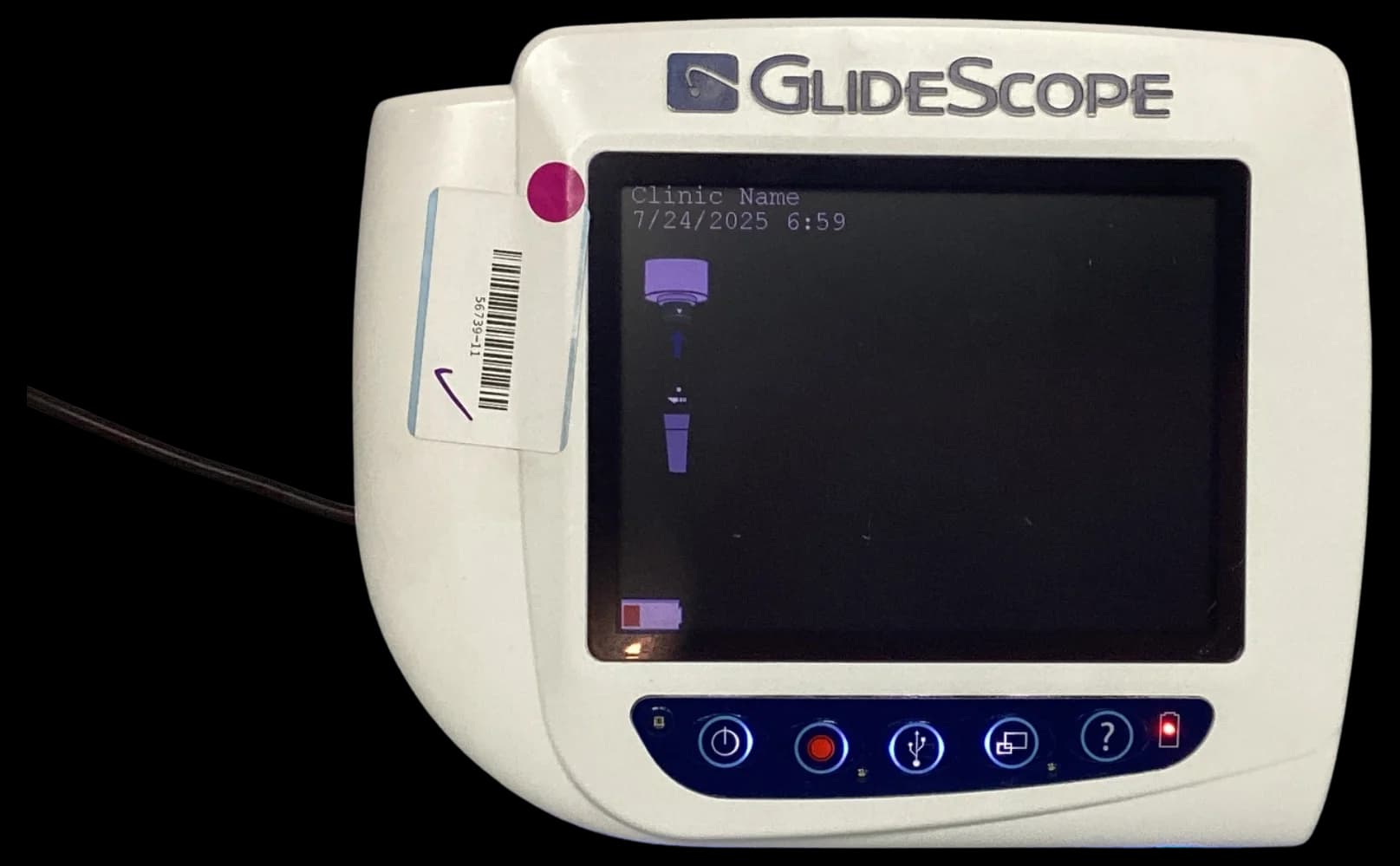 VERATHON GlideScope Cobalt AVL Video laryngoscope