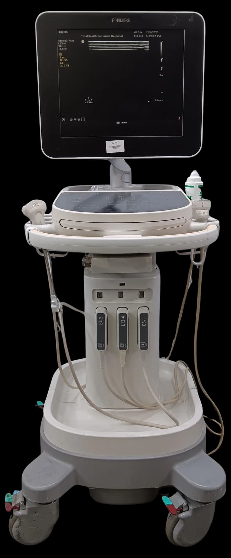 PHILIPS Sparq Ultrasound Machine
