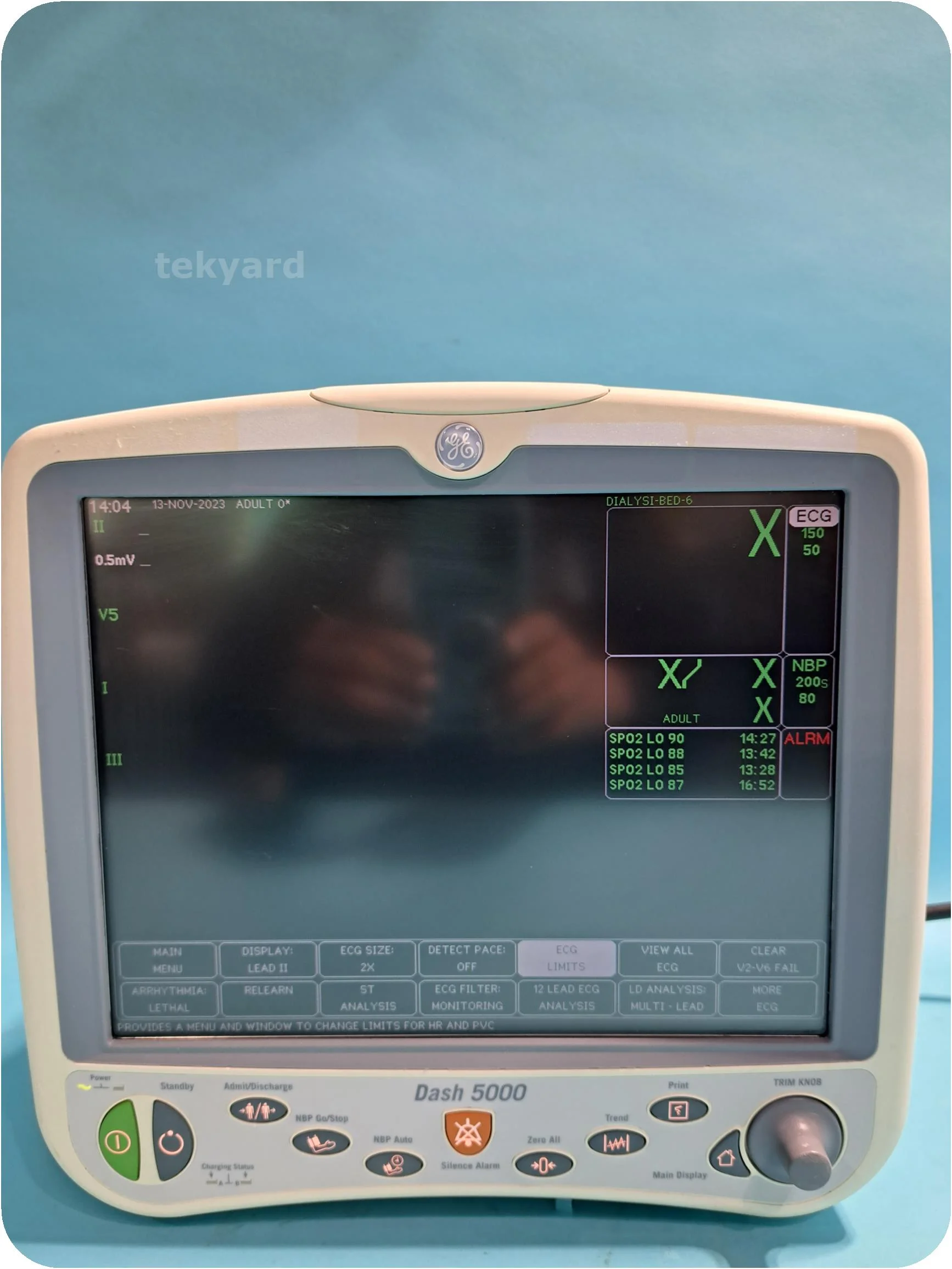 GE Dash 5000 Patient monitor