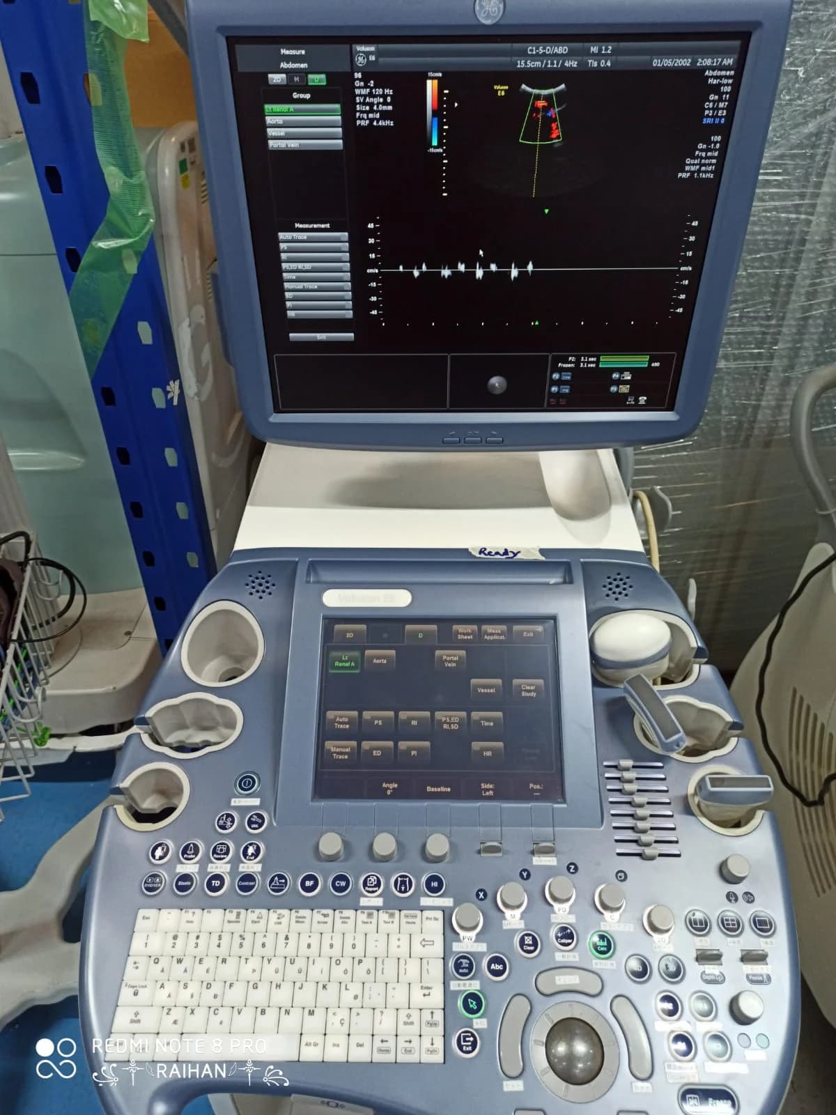 GE Voluson E6 Ultrasound Machine