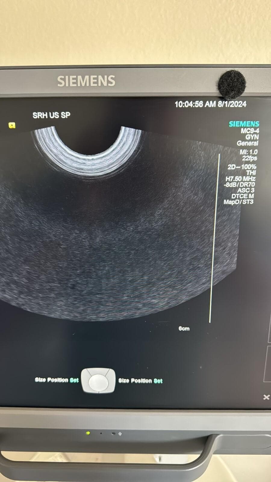 SIEMENS MC9-4 Endocavity probe