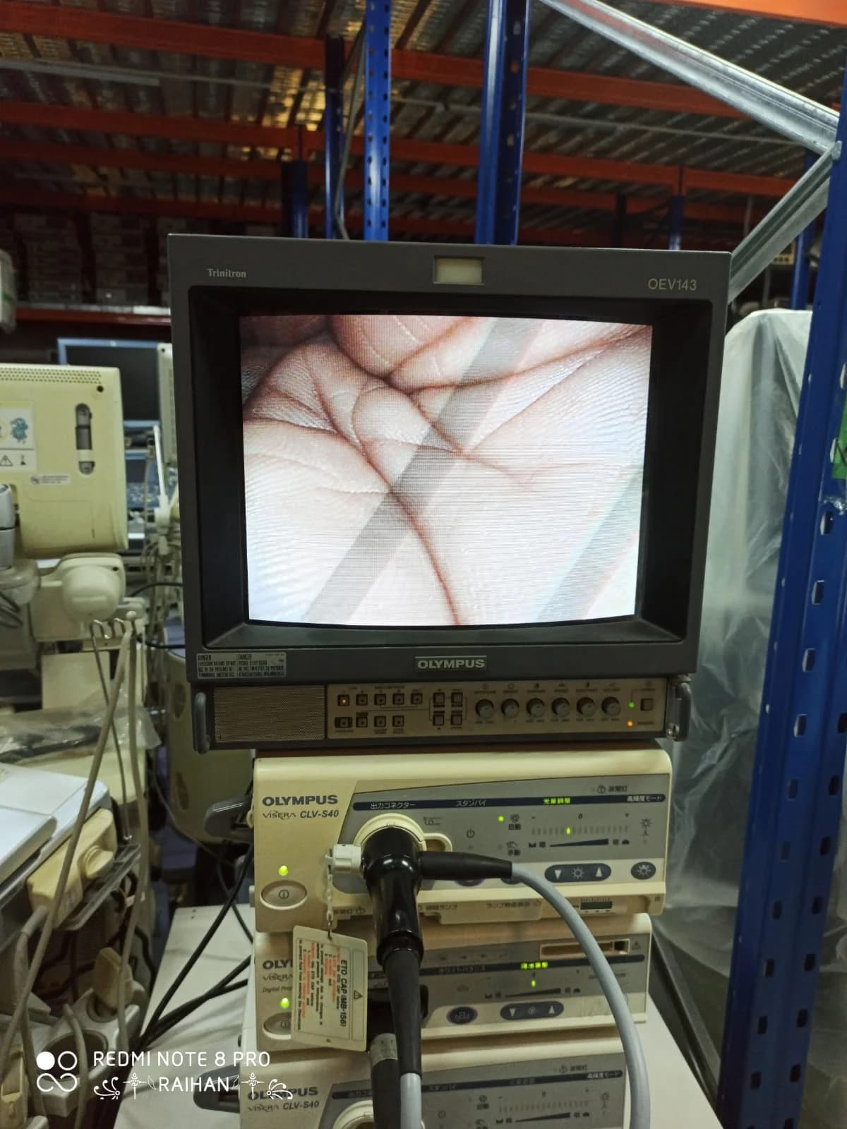 OLYMPUS VISERA OTV-S7/CLV-S40 Endoscopy System