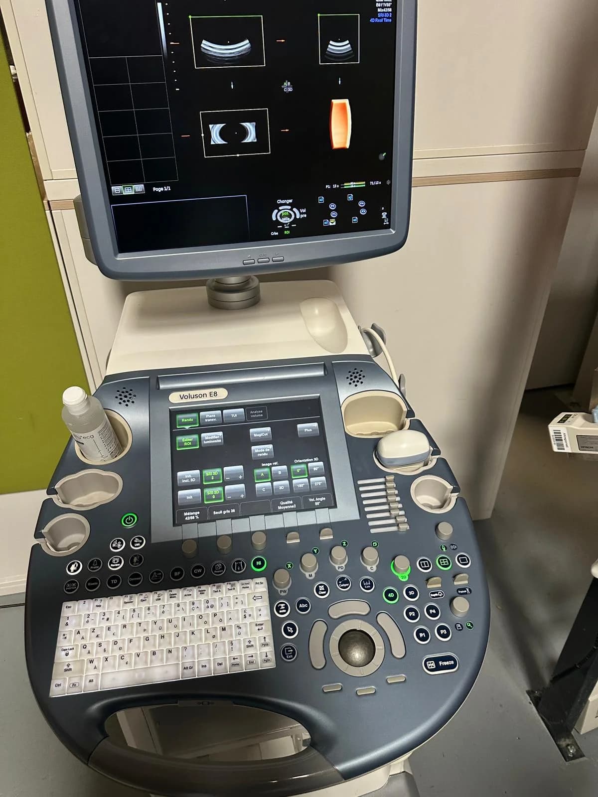 GE Voluson E8 Ultrasound Machine