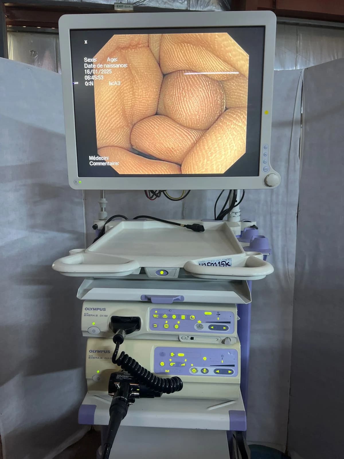 OLYMPUS Evis Exera II CV-180/CLV-180 Endoscopy System