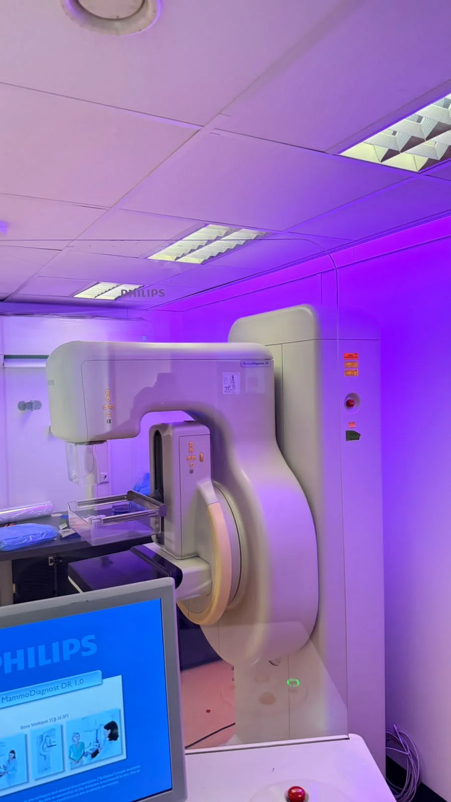 PHILIPS MammoDiagnost DR Mammography Machine