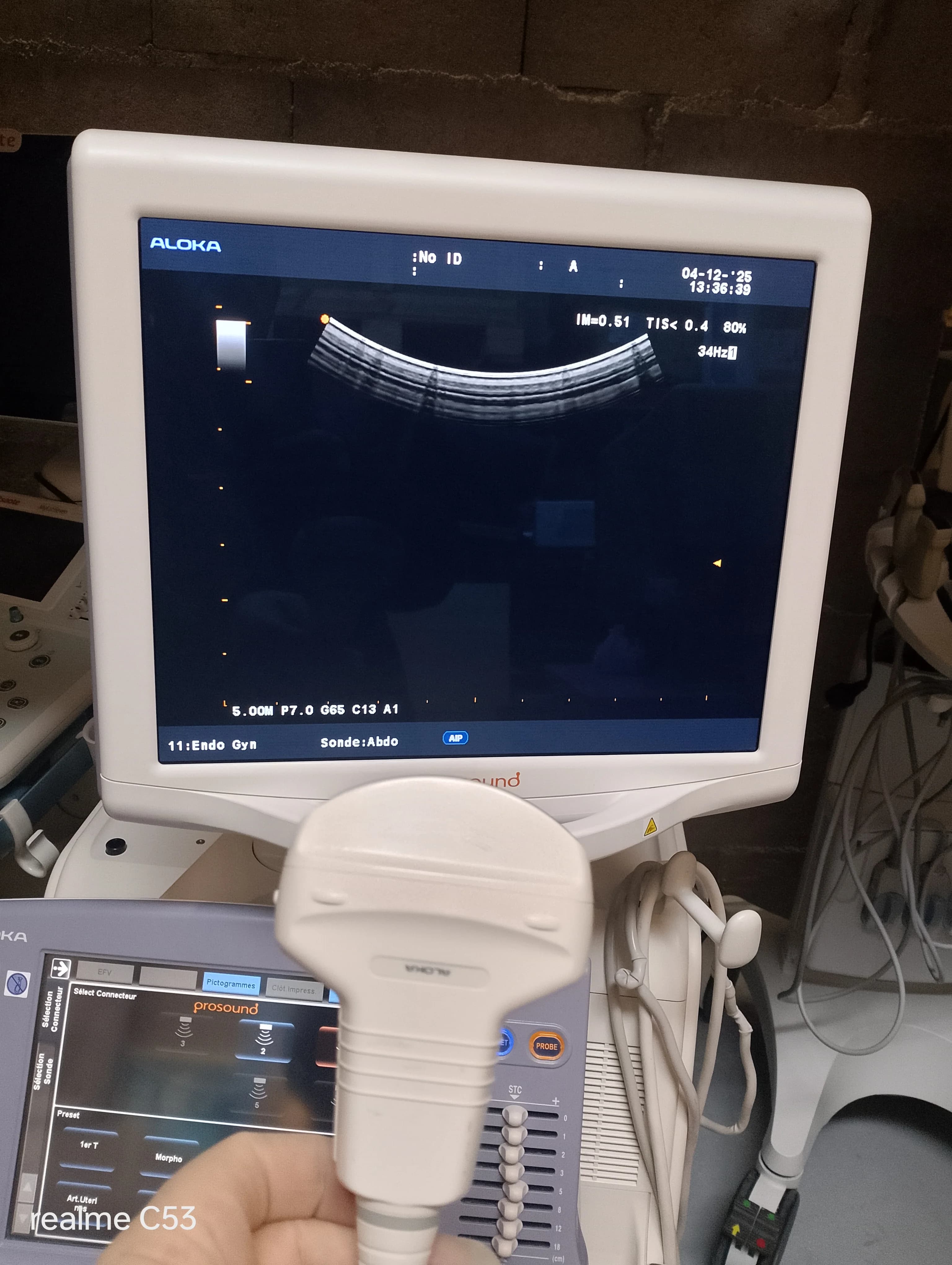 ALOKA UST-9130 Convex Probe