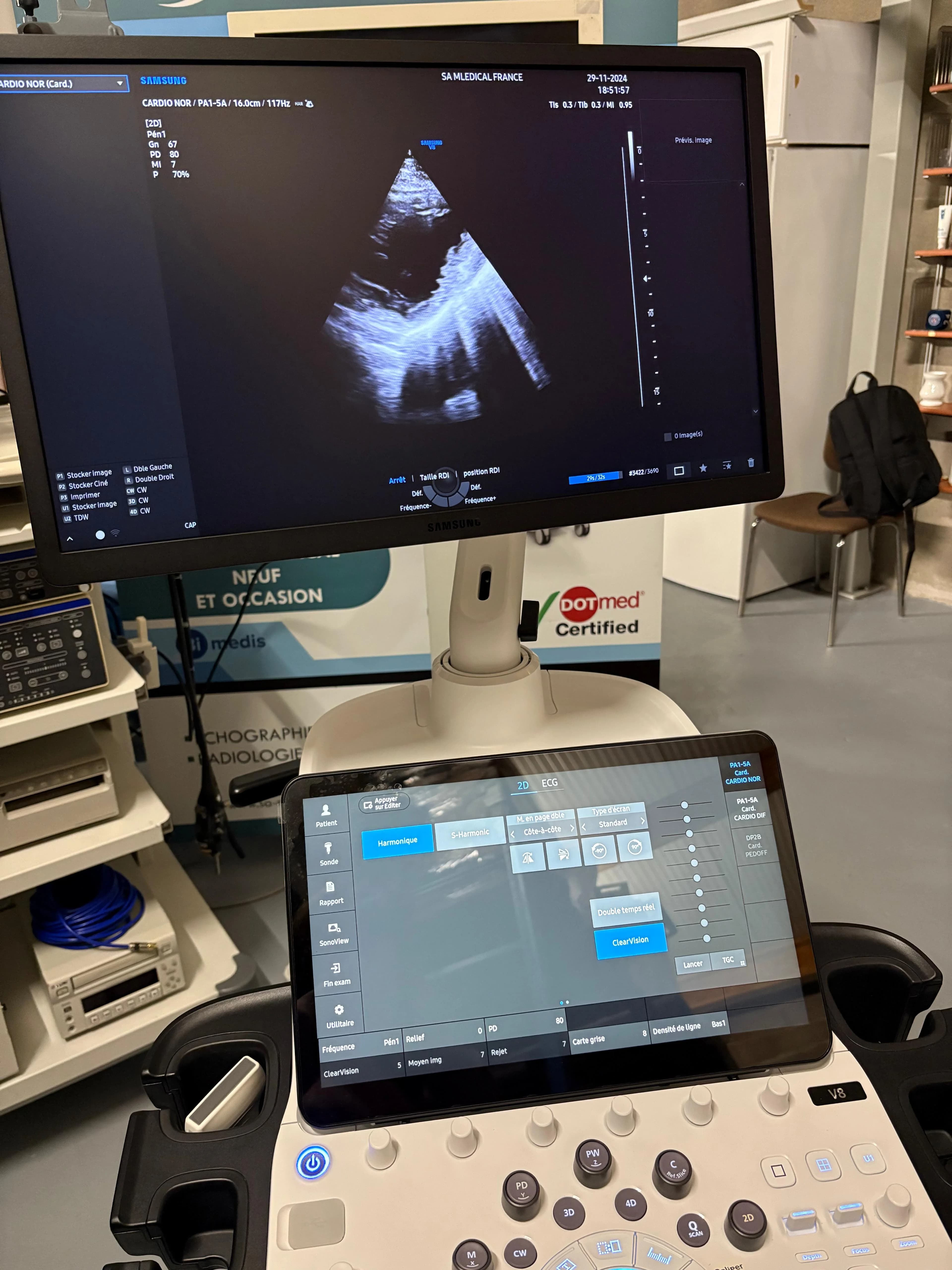 SAMSUNG V8 Ultrasound Machine