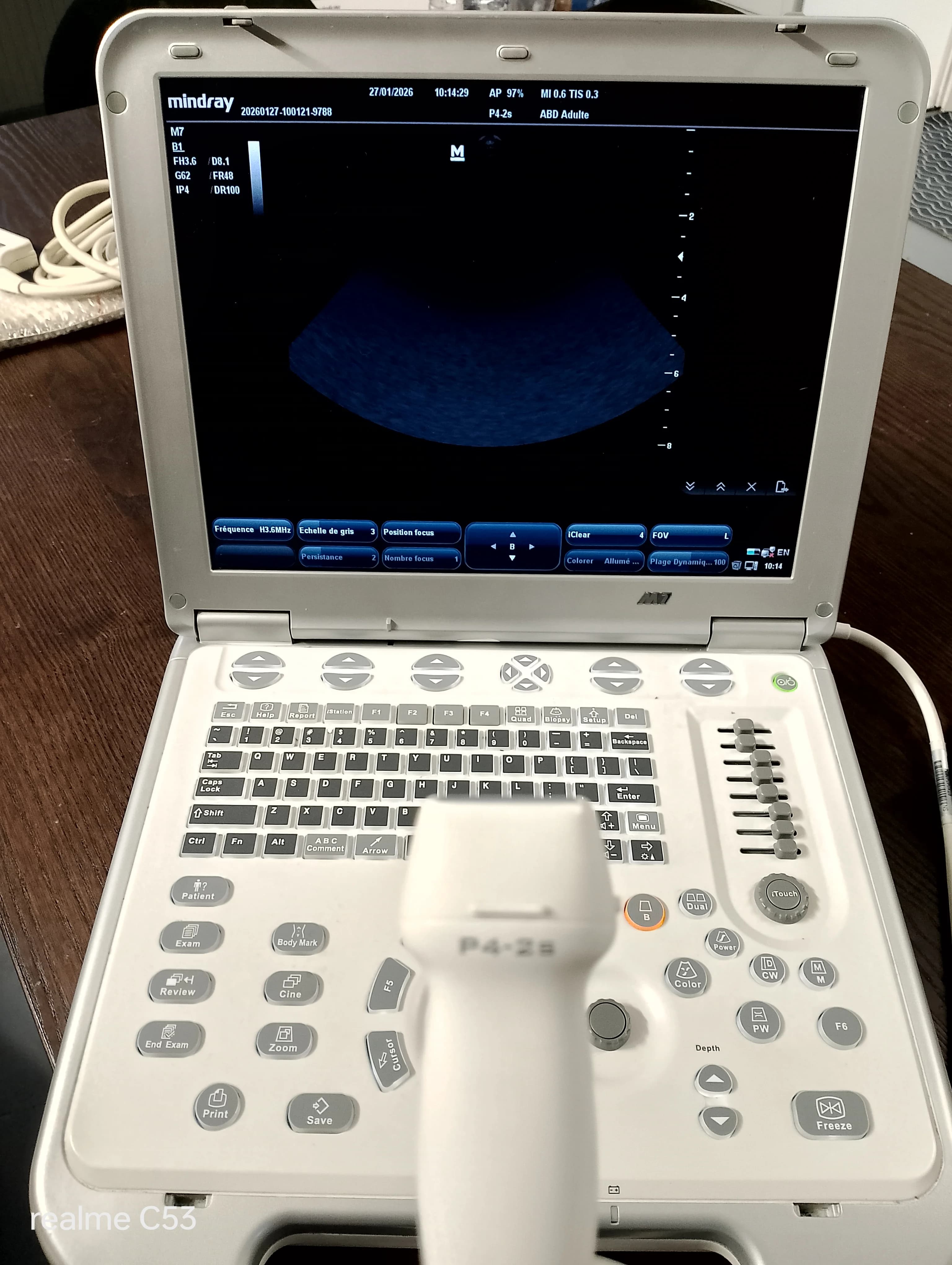 MINDRAY P4-2S Cardiac Probe