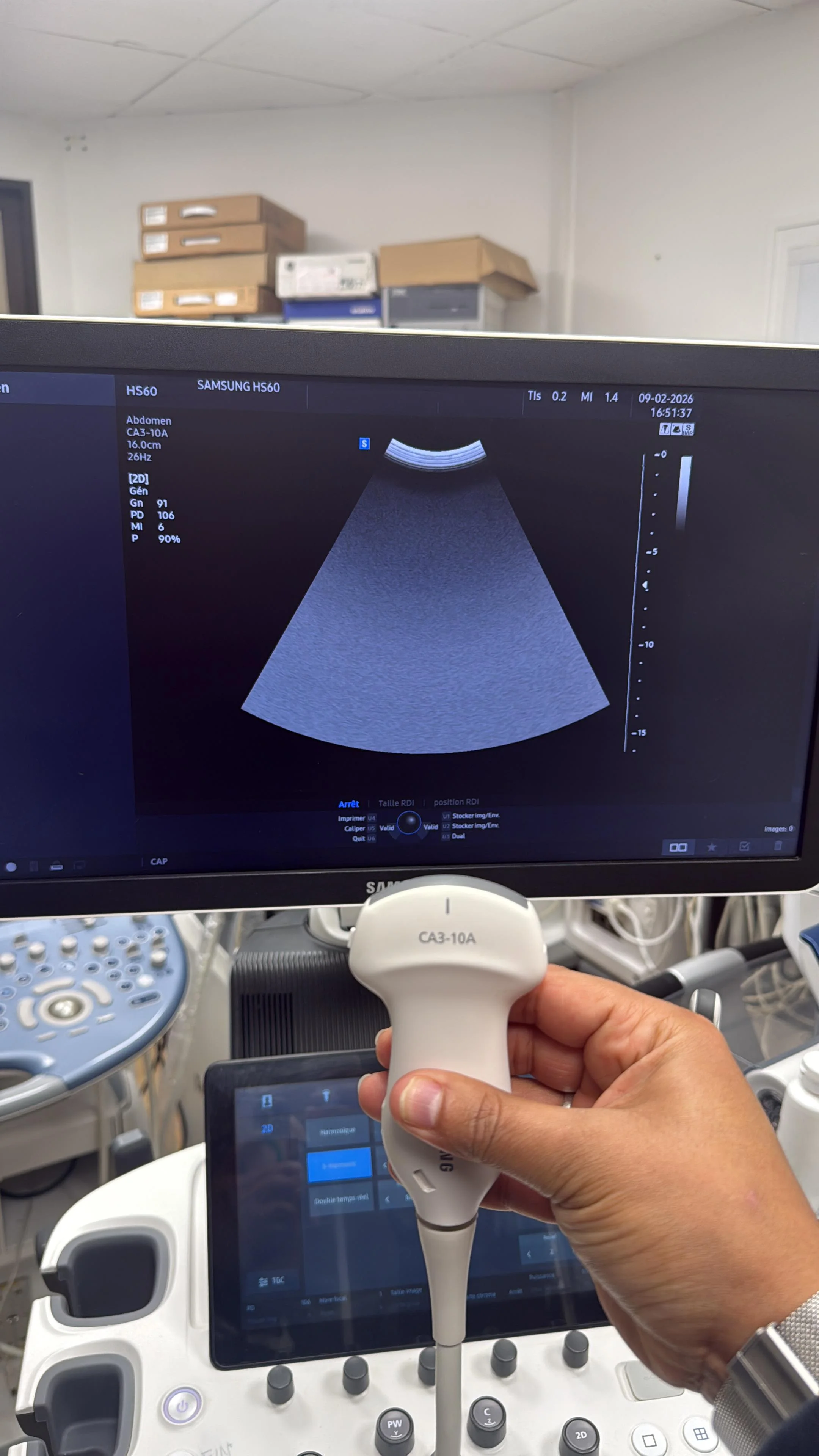 SAMSUNG CA3-10A Convex Probe