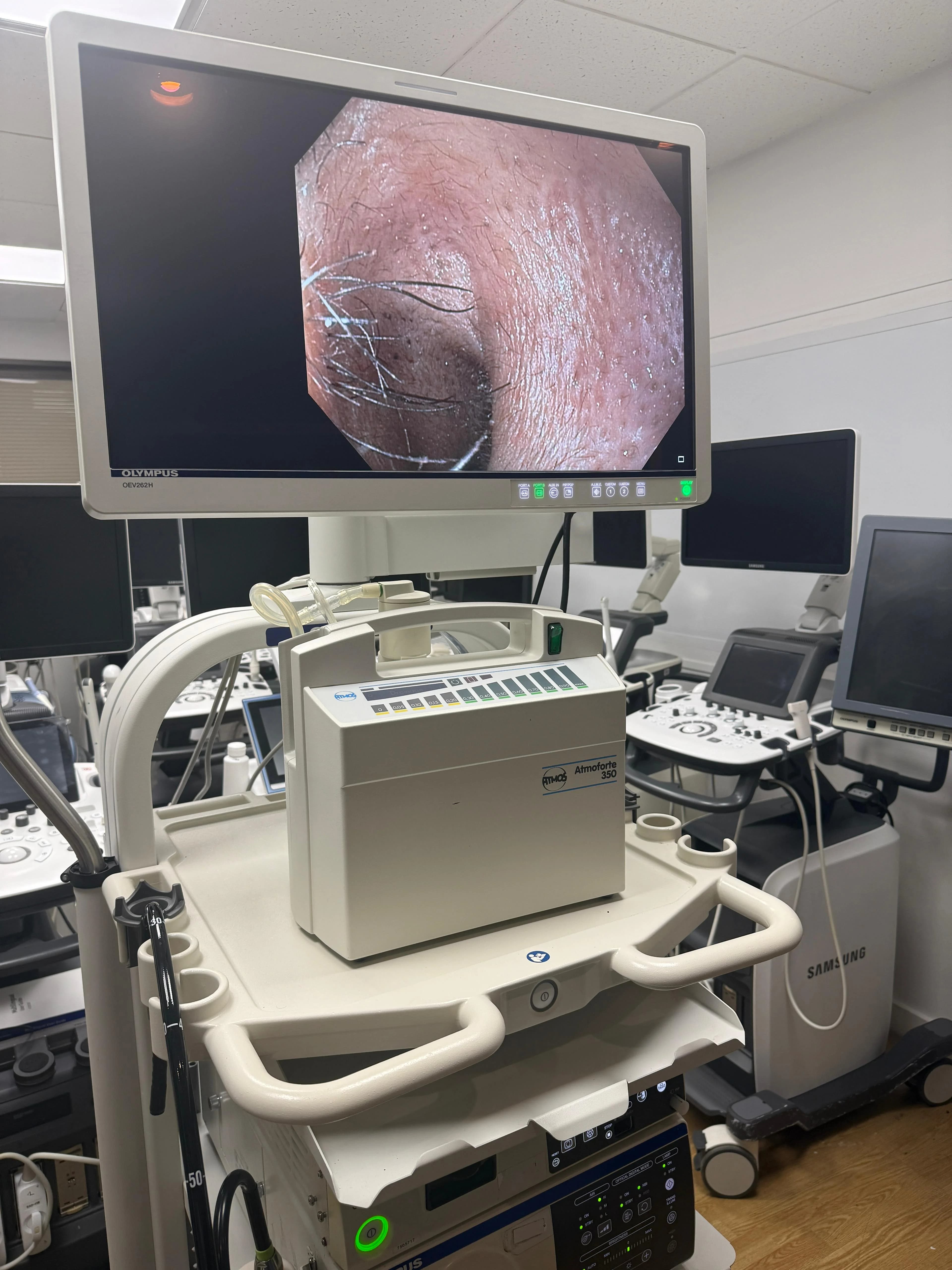 OLYMPUS Evis Exera III CV-190/CLV-190 Endoscopy System