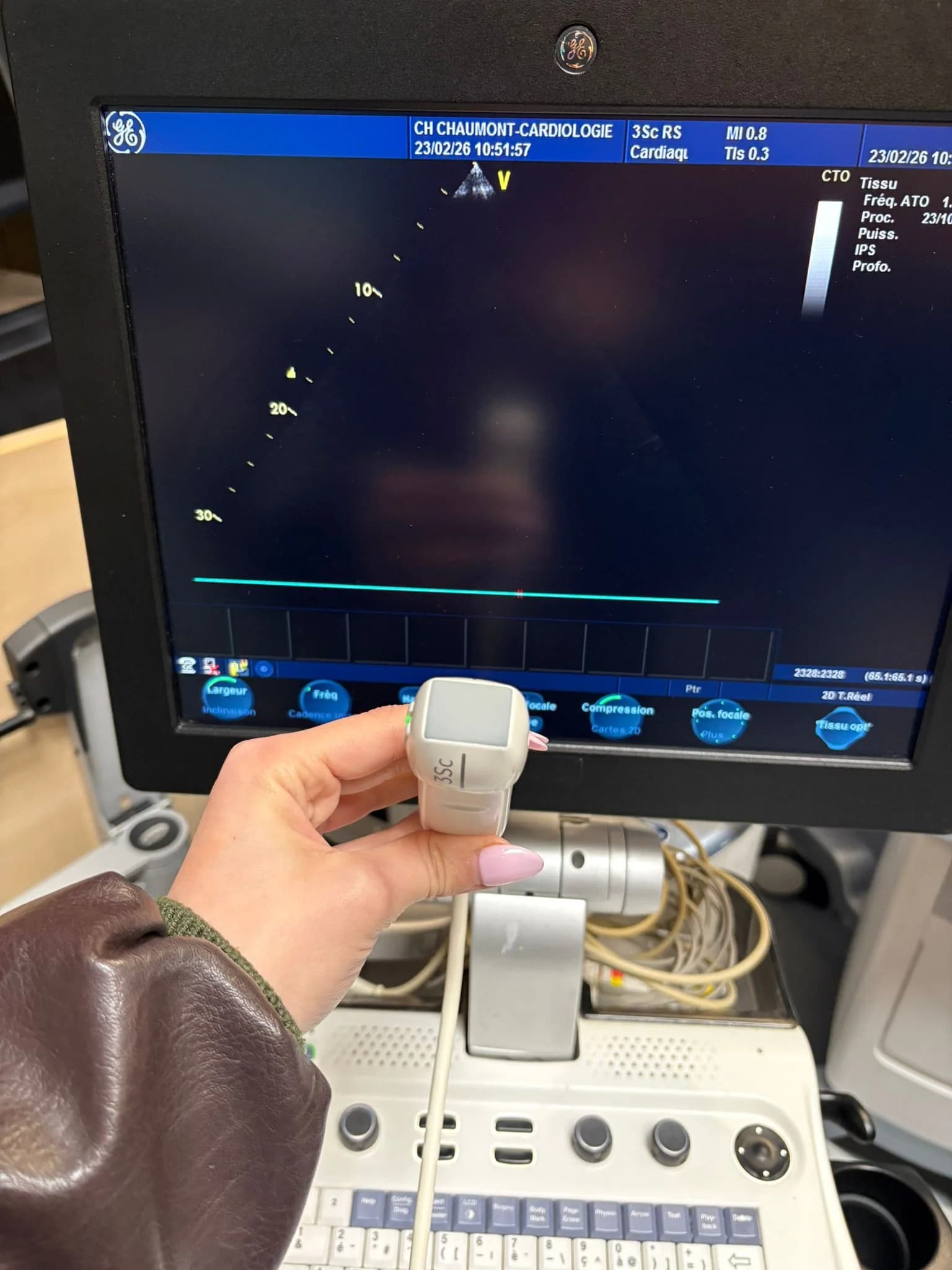 GE 3Sc-RS Cardiac Probe