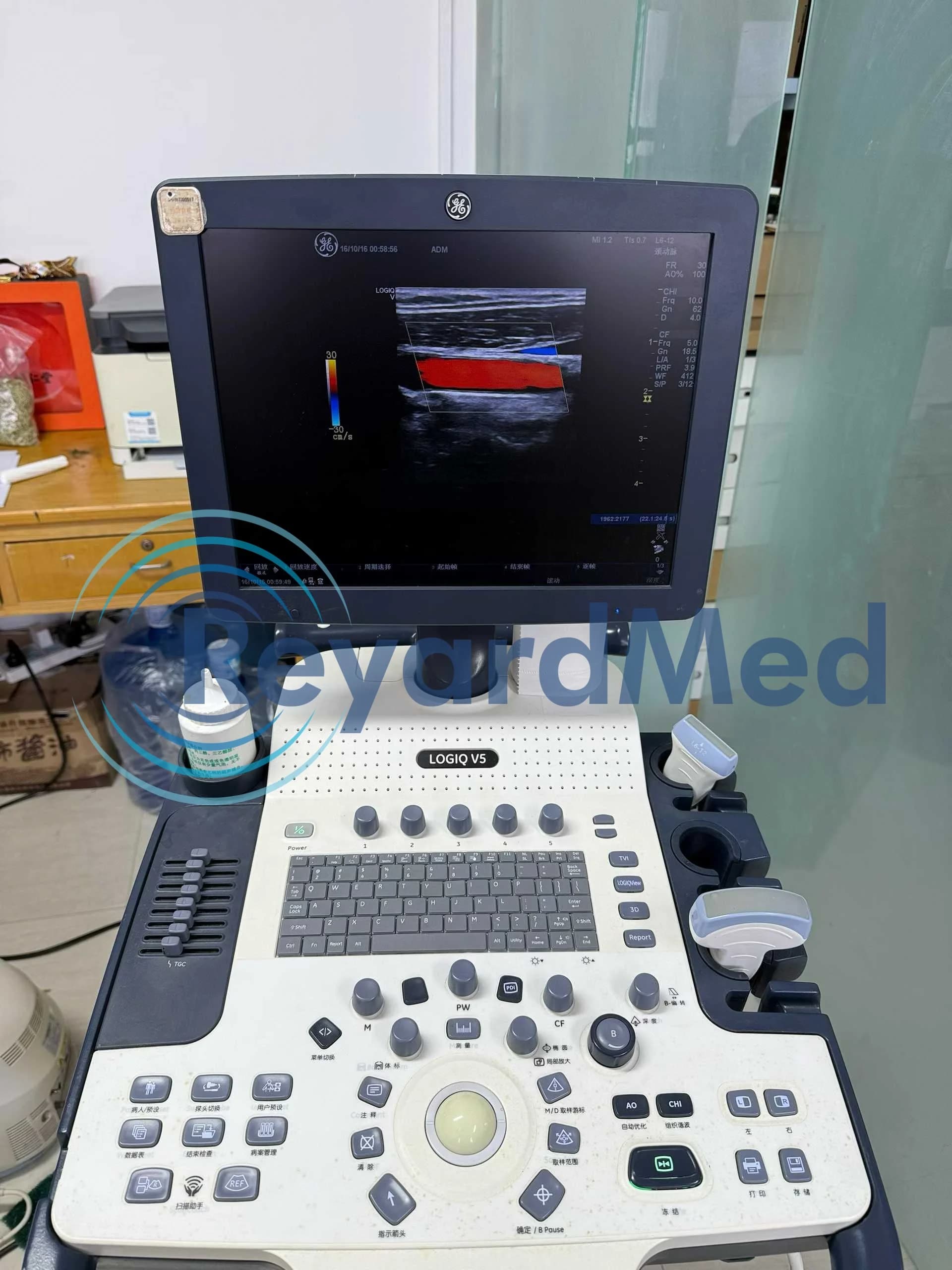 GE Logiq V5 Ultrasound Machine