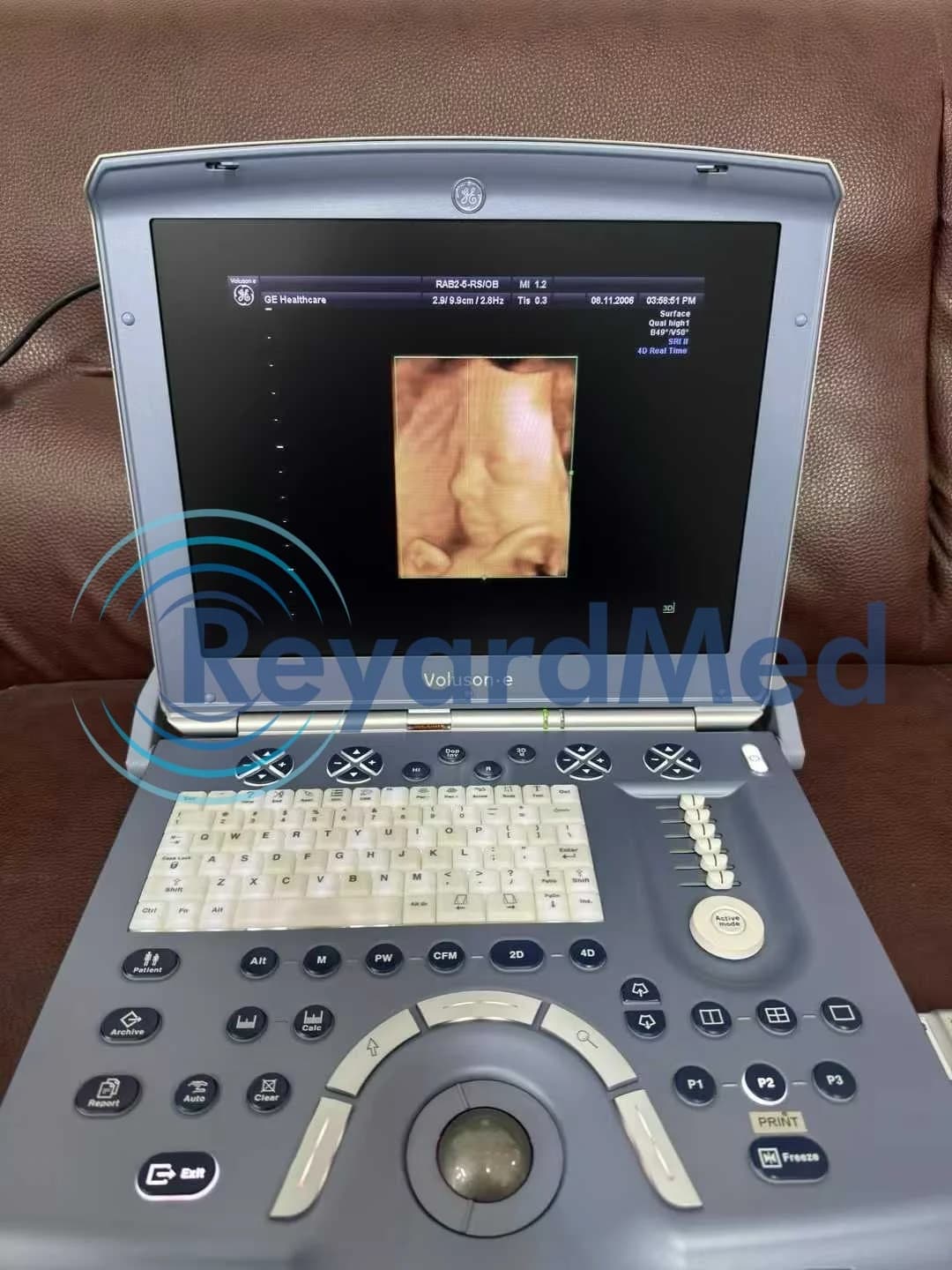 GE Voluson E Ultrasound Machine