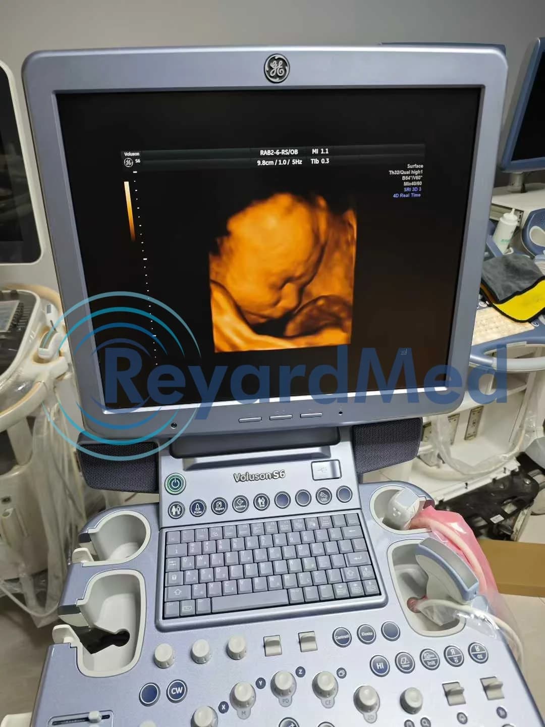 GE Voluson S6 Ultrasound Machine