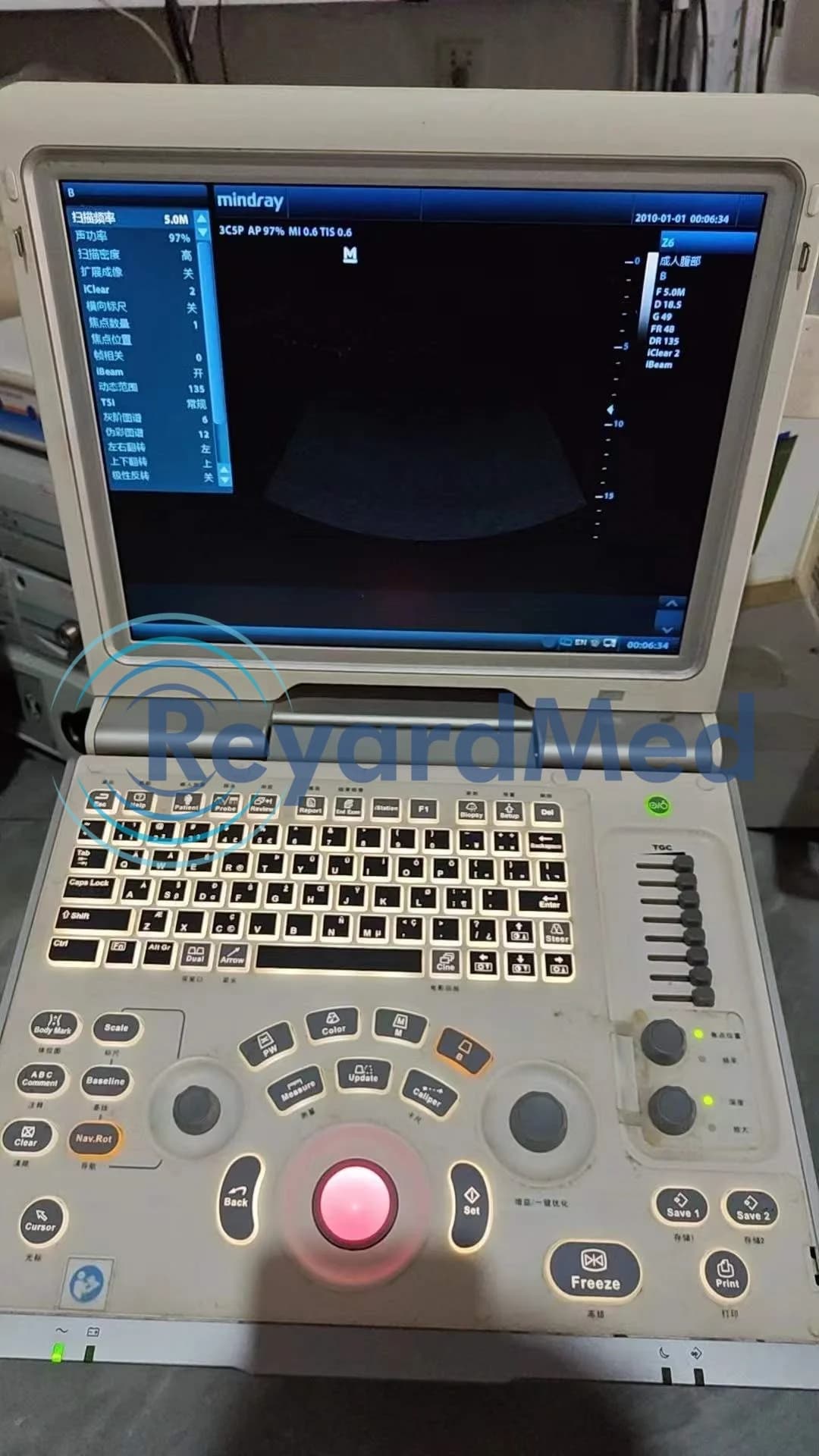 MINDRAY Z6 Ultrasound Machine
