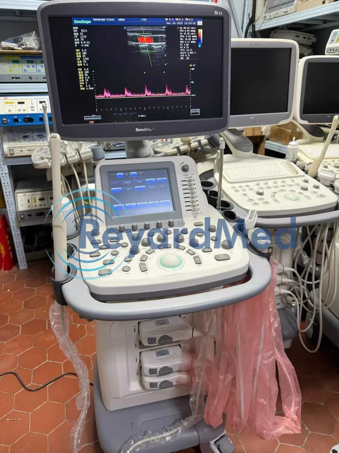 SONOSCAPE S15 Ultrasound Machine