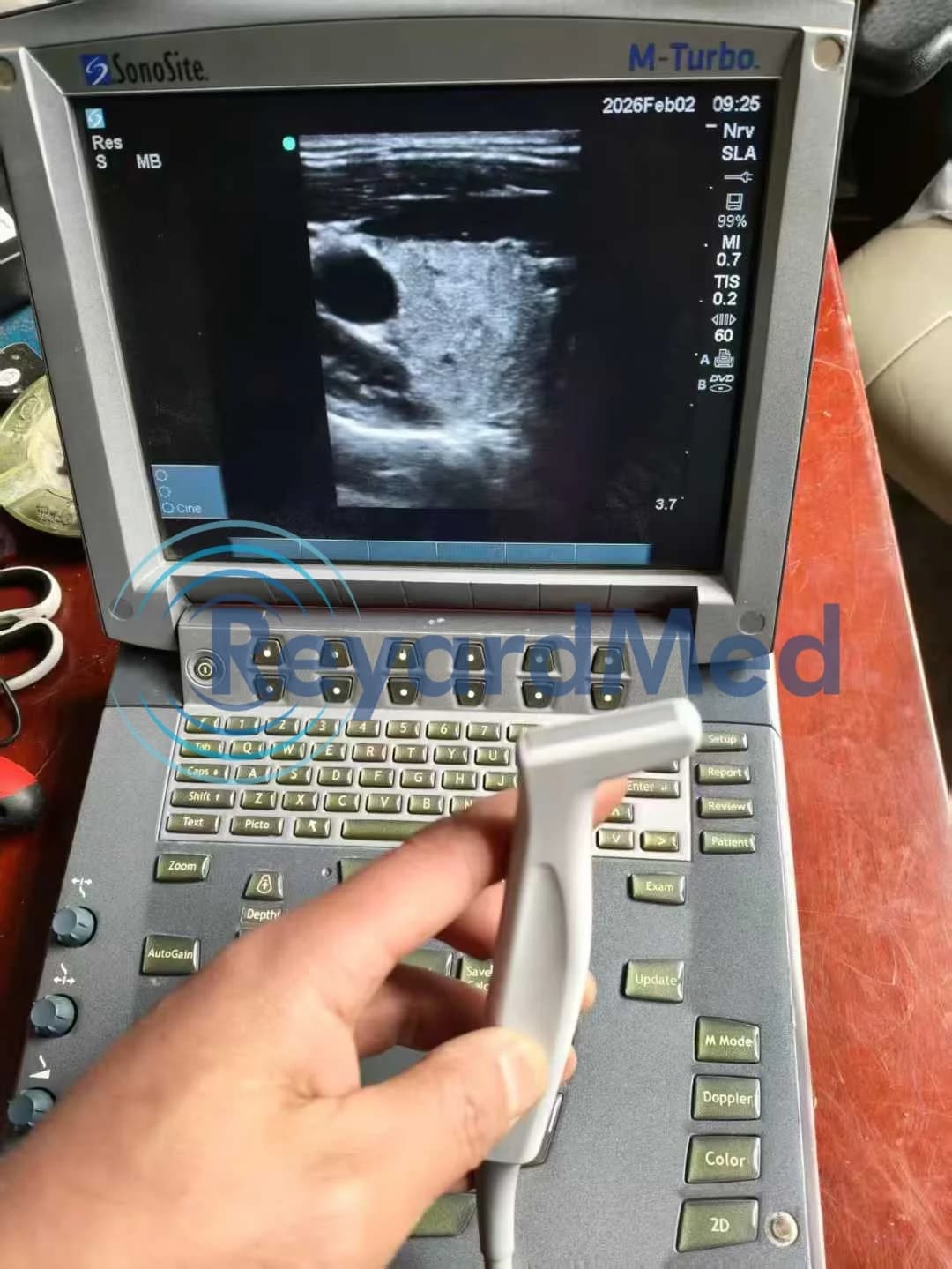 SONOSITE M-Turbo Ultrasound Machine