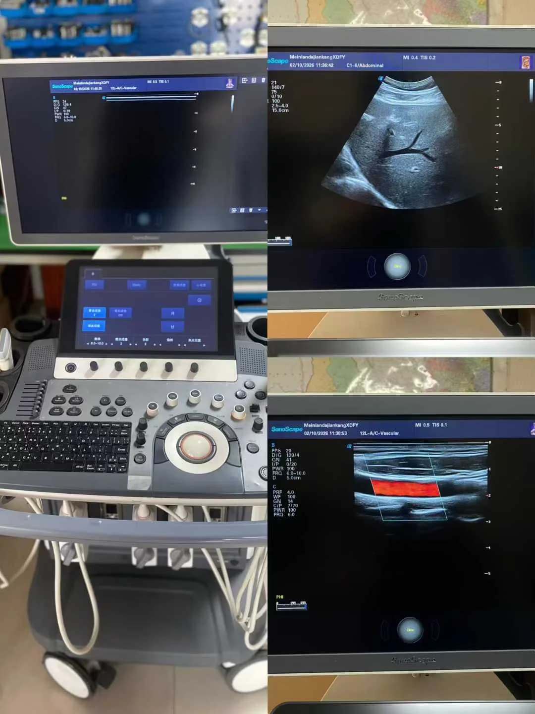 SONOSCAPE S50 Ultrasound Machine