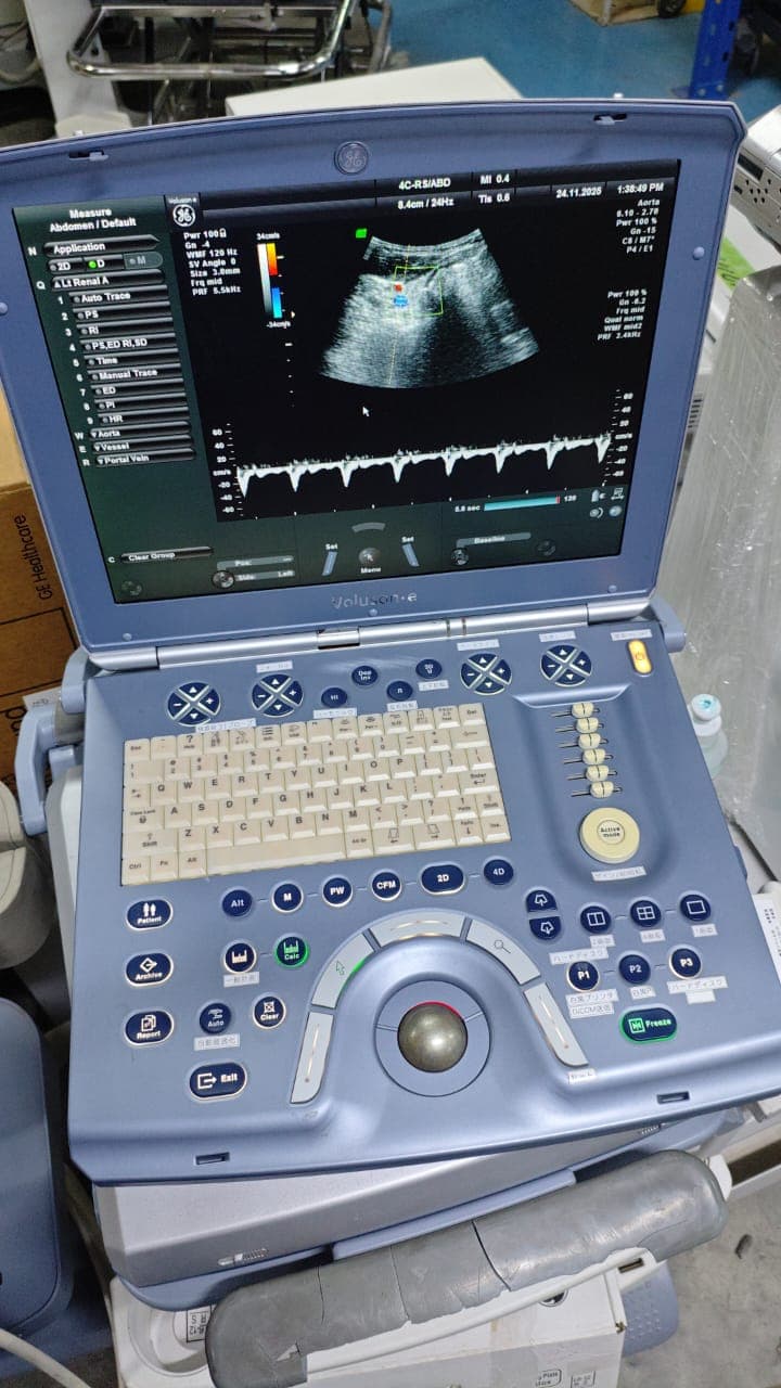 GE Voluson E Ultrasound Machine