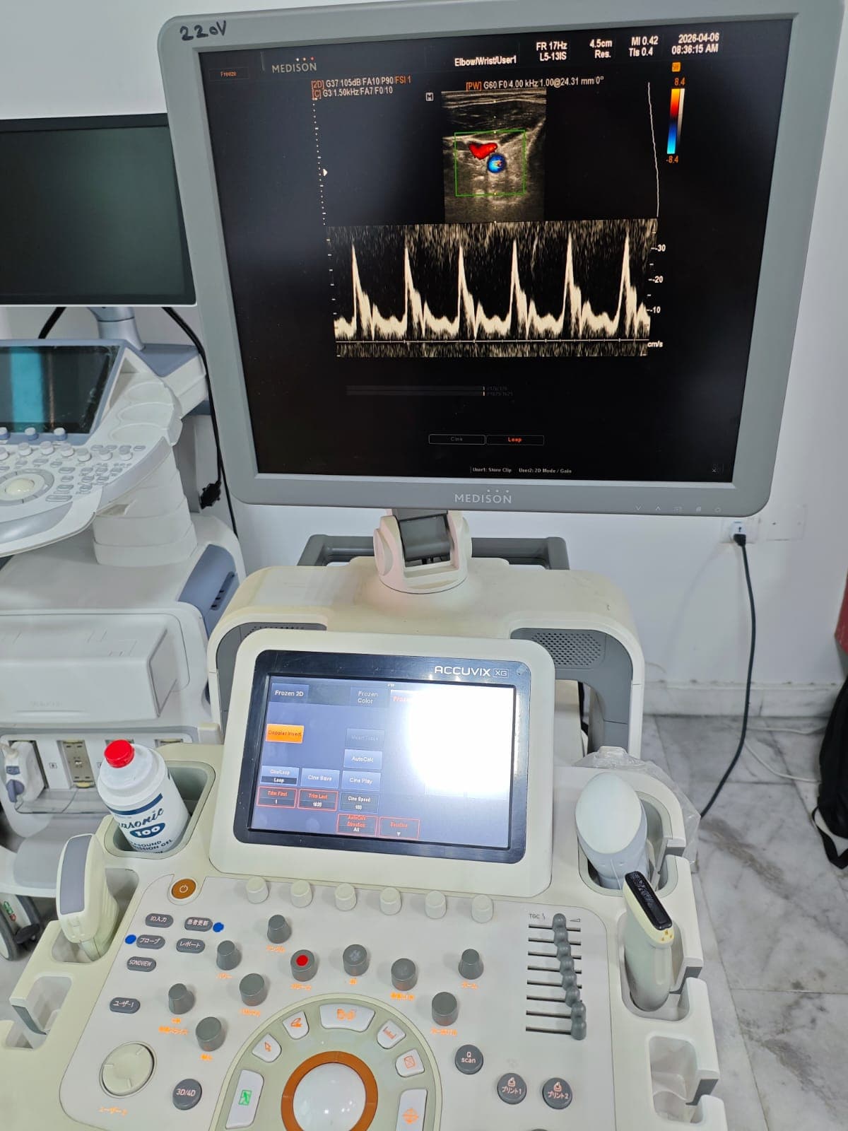 SAMSUNG Accuvix XG Ultrasound Machine