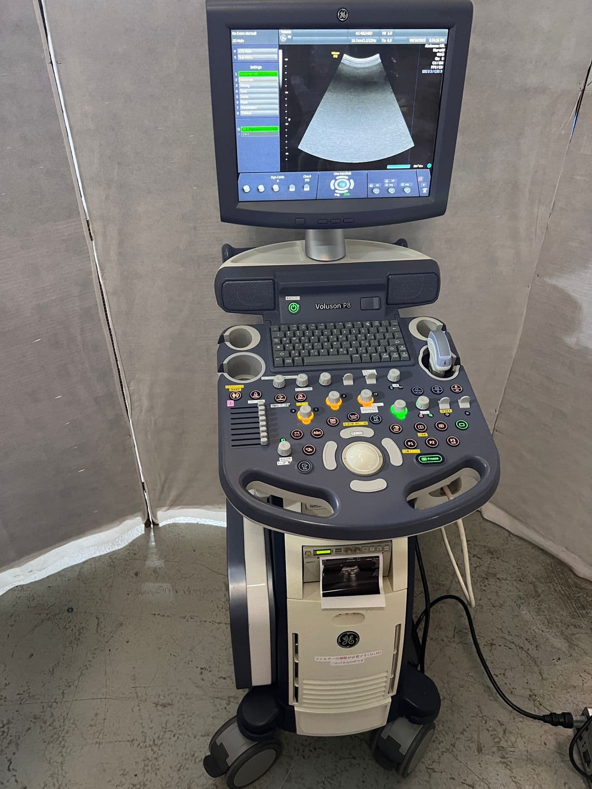 GE Voluson P8 Ultrasound Machine