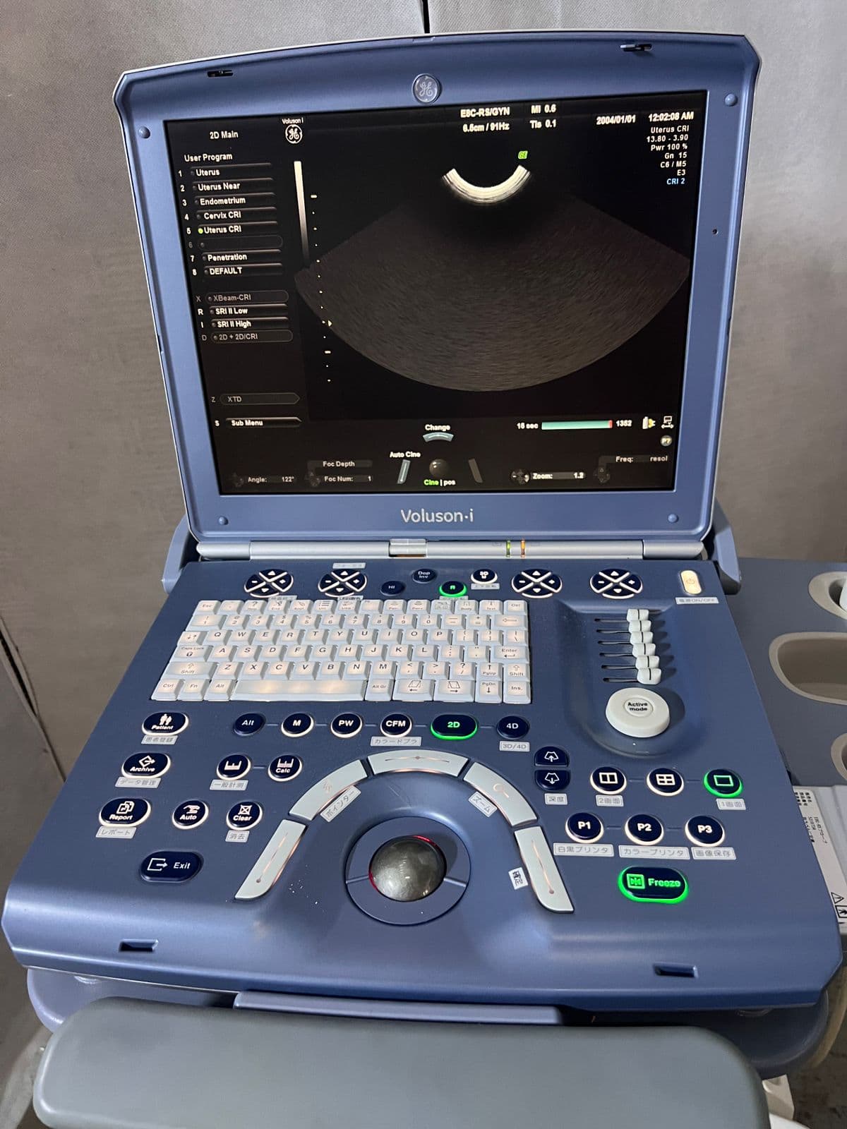 GE Voluson I Ultrasound Machine