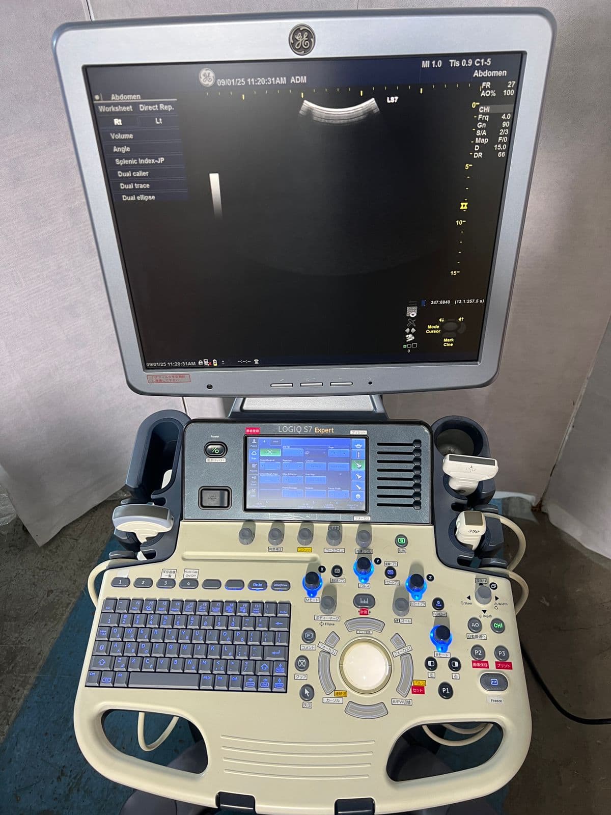 GE Logiq S7 Expert Ultrasound Machine