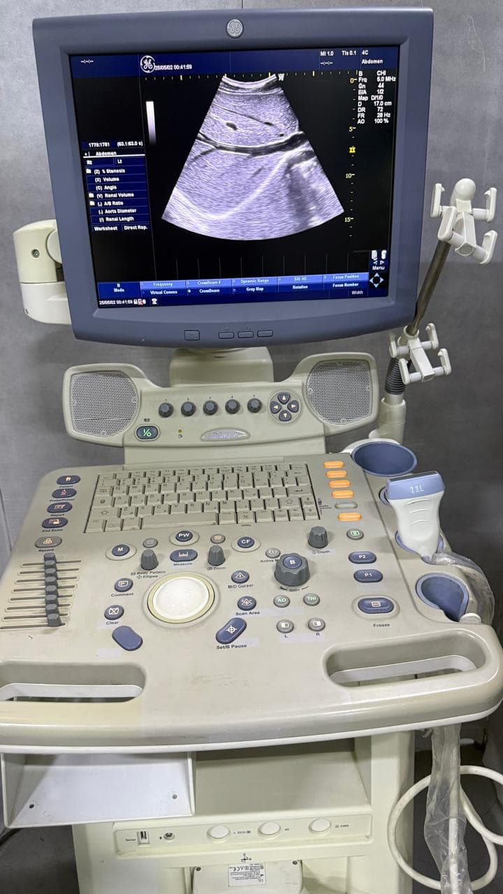 GE Logiq P5 Ultrasound Machine