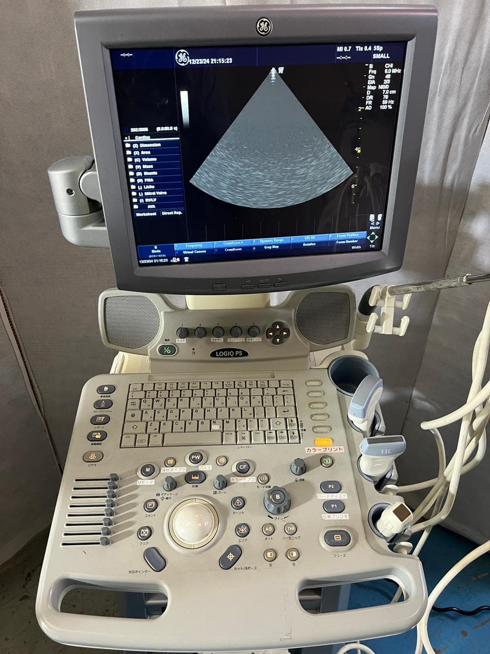 GE Logiq P5 Ultrasound Machine