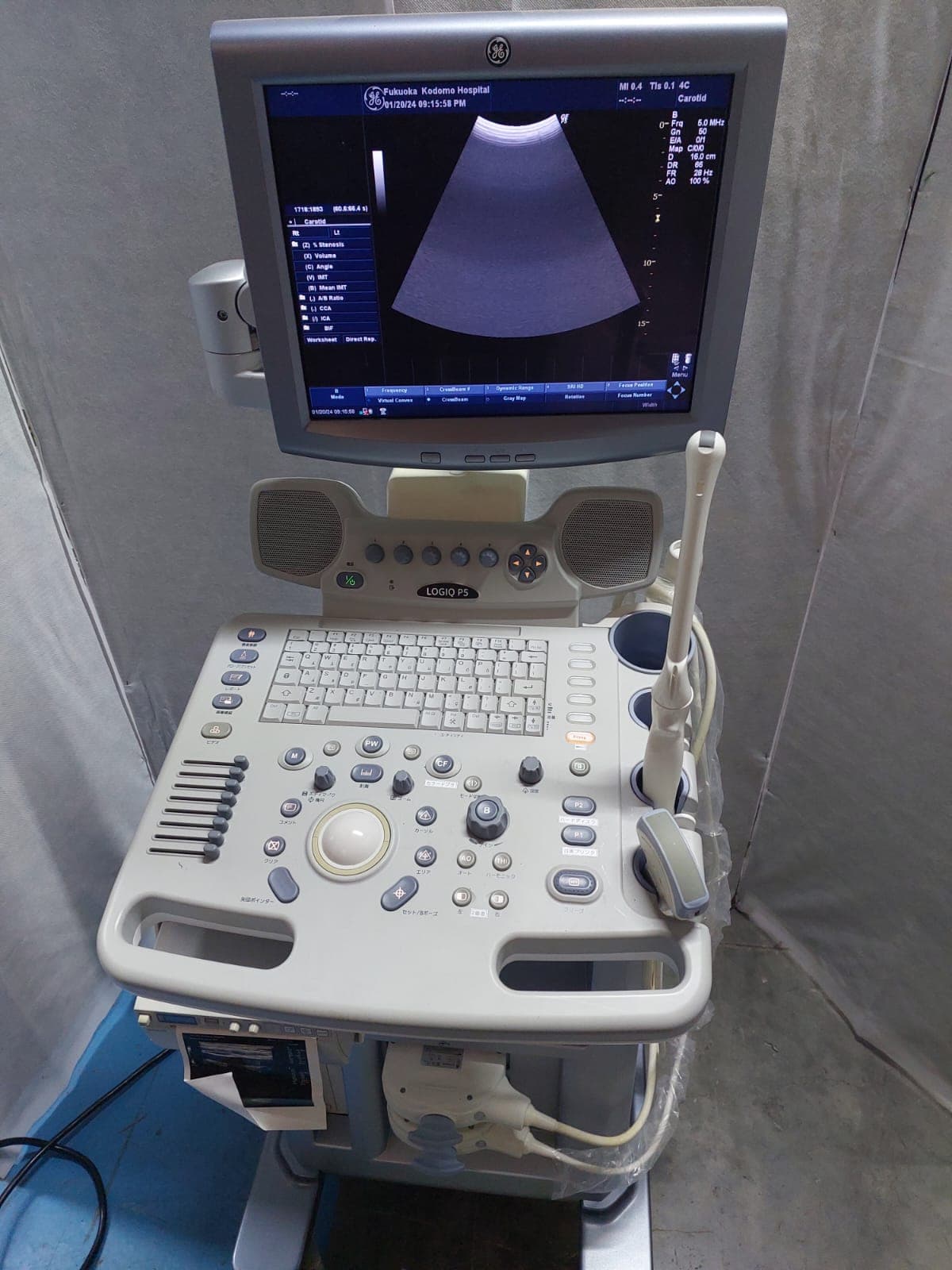 GE Logiq P5 Ultrasound Machine