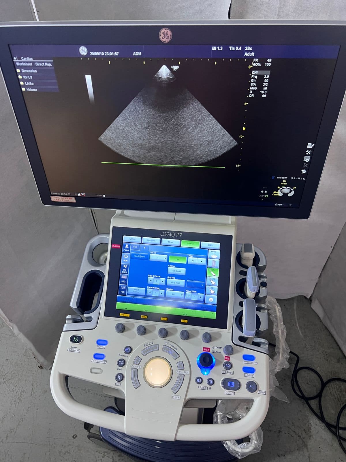 GE Logiq P7 Ultrasound Machine