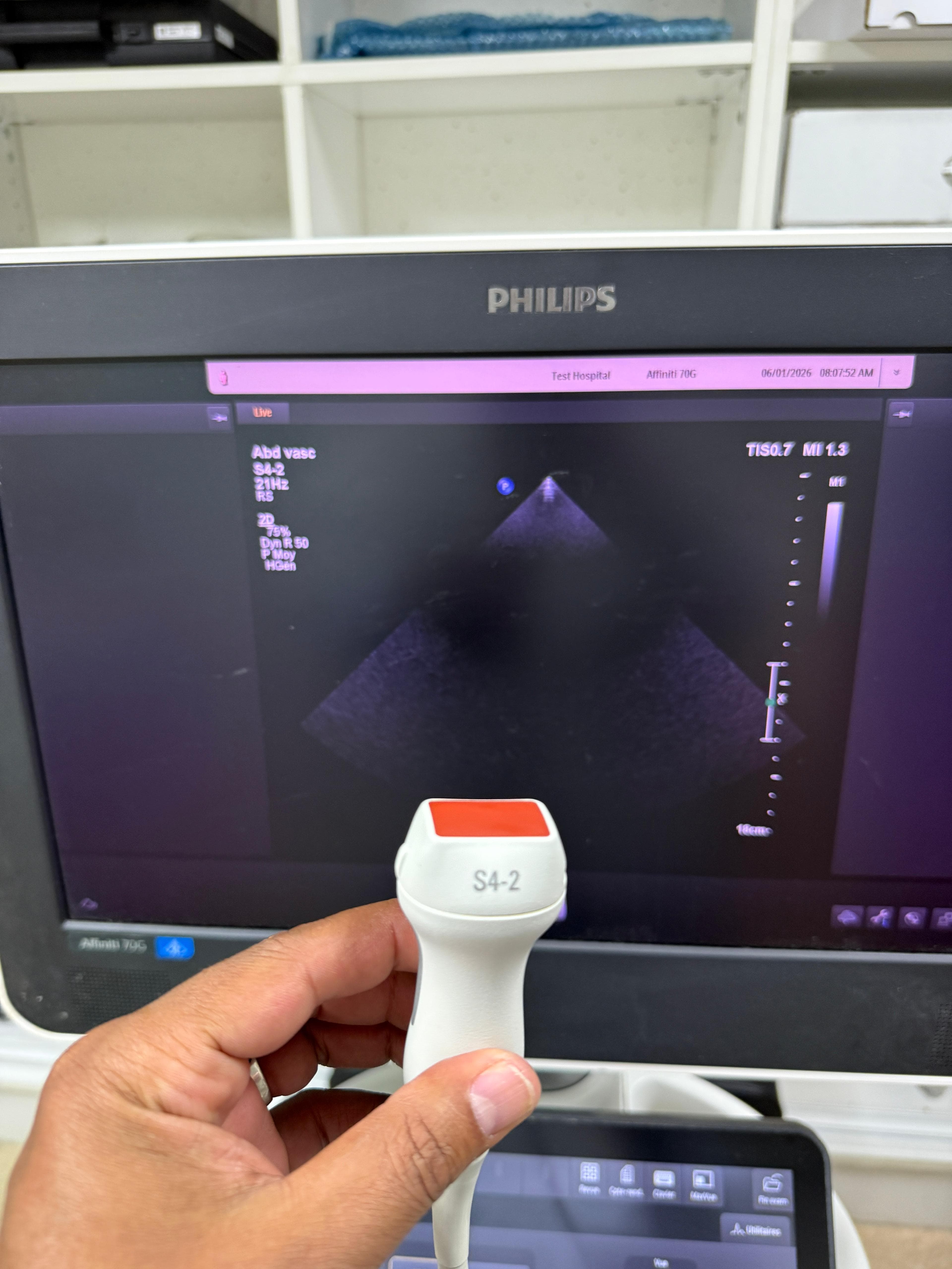 PHILIPS S4-2 Cardiac Probe