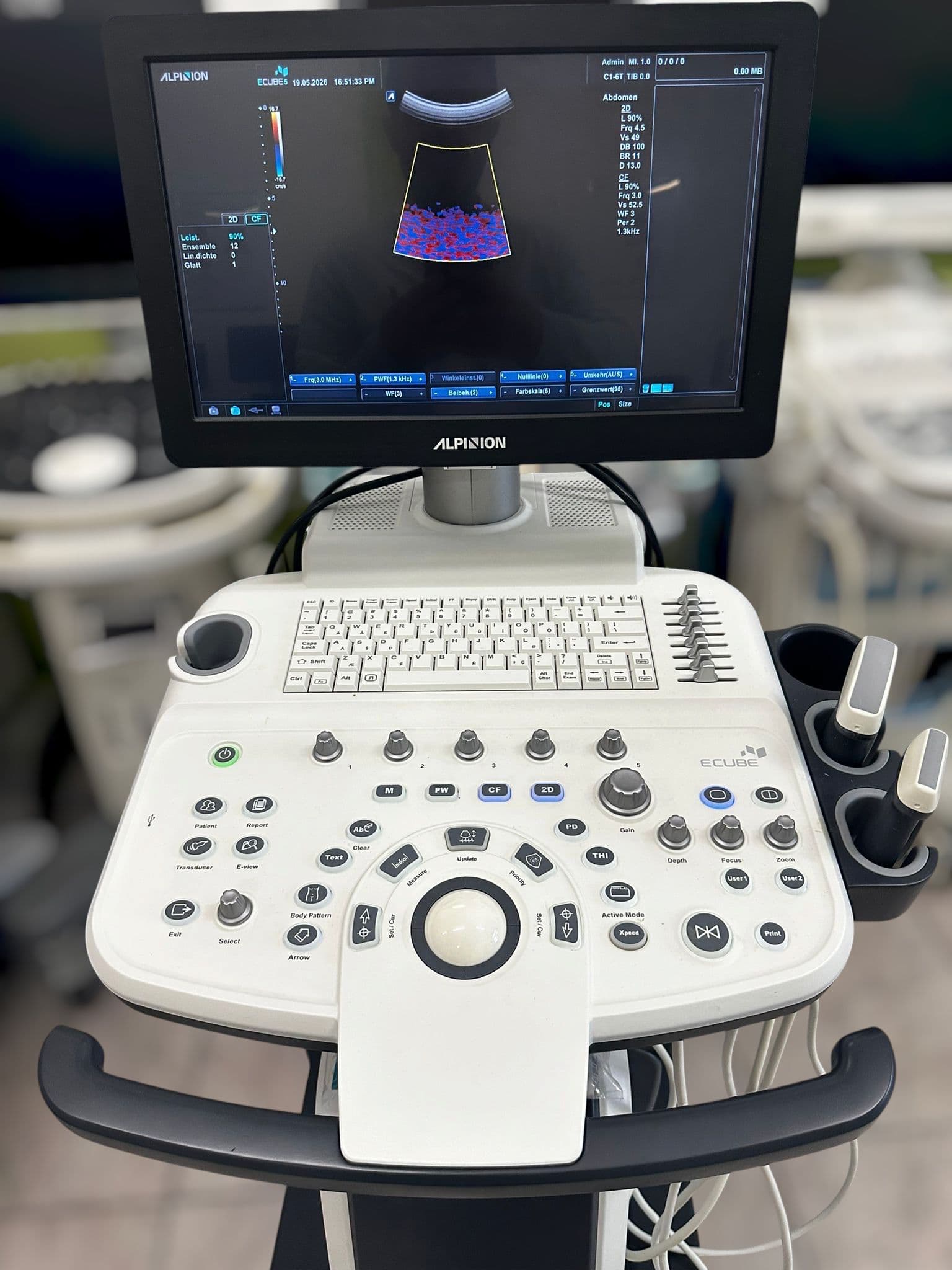 ALPINION E-CUBE 5 Ultrasound Machine