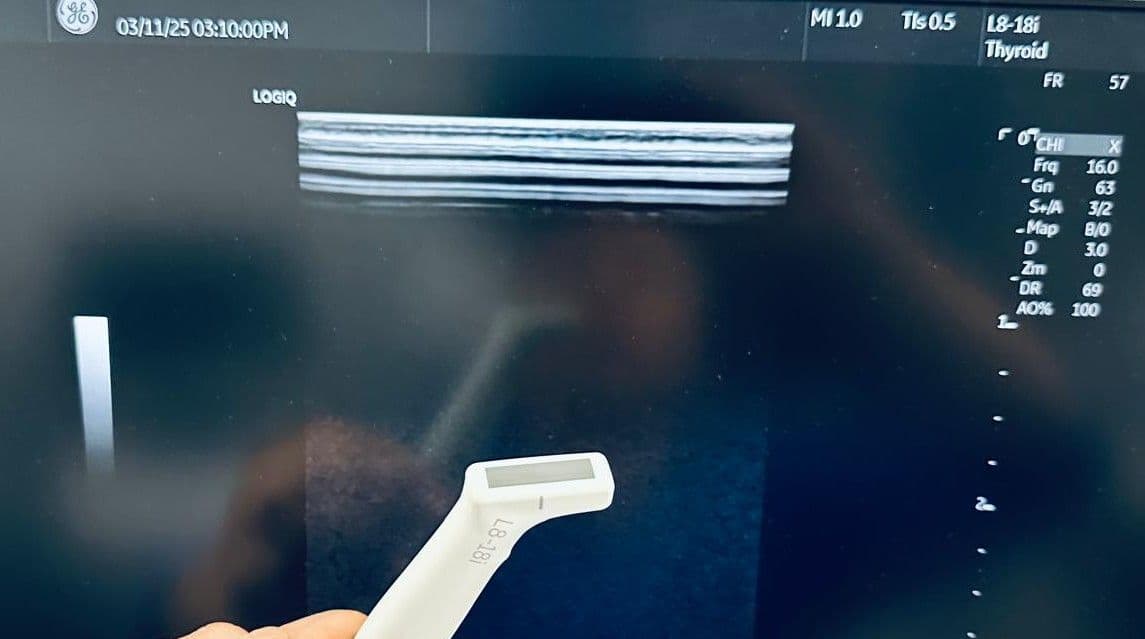 For Sale GE L8-18i-D Ultrasound Transducer