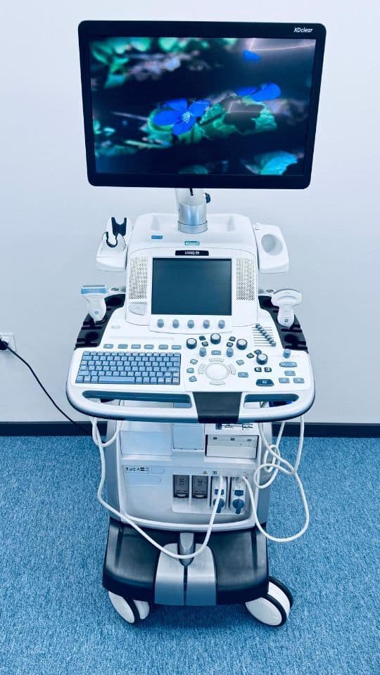For Sale GE Logiq E9 XDclear R6 2016 Linear & Convex General Ultrasound